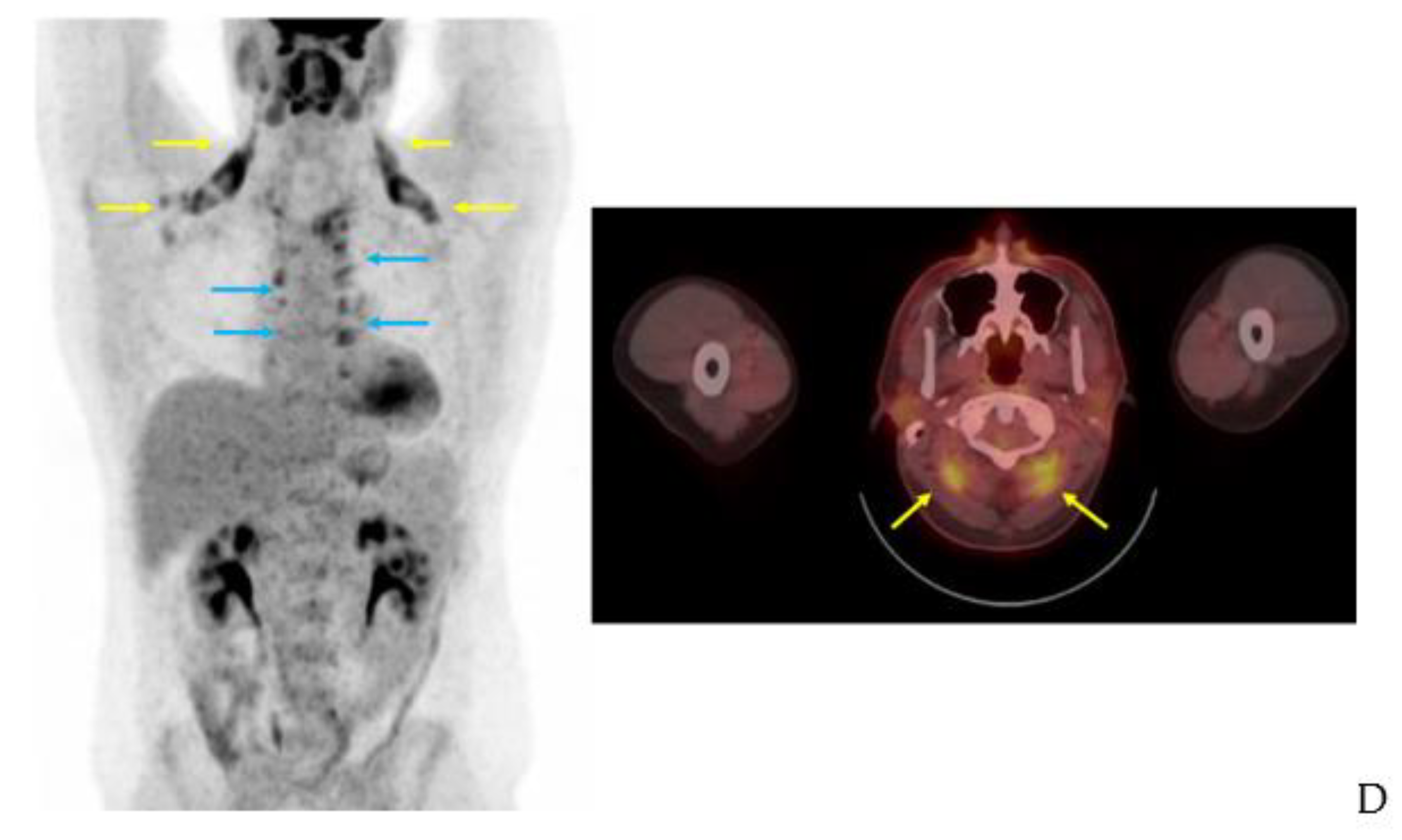 Ijms 20 05509 g006b Ijms 20 05509 g006b