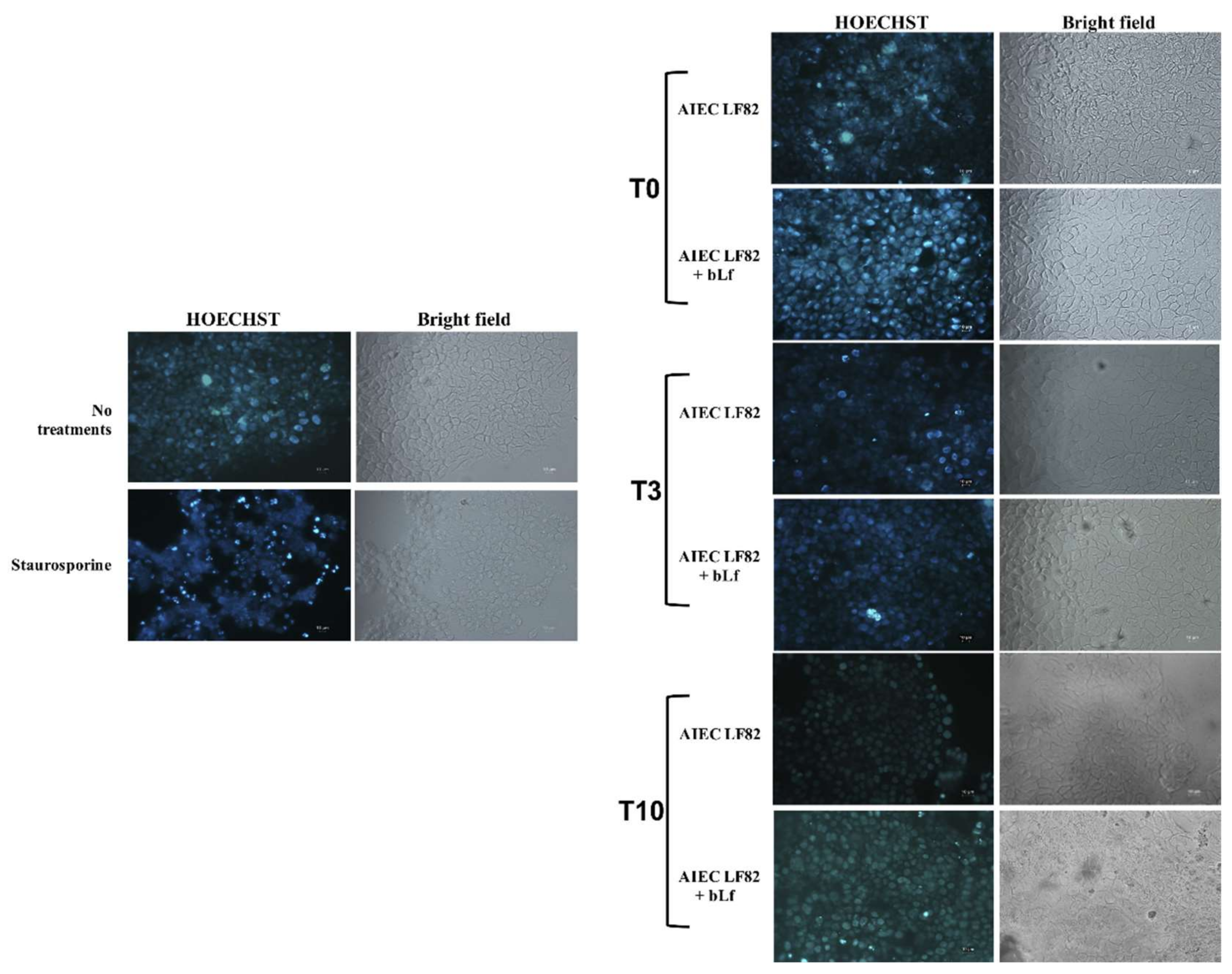 Ijms 20 05666 g005 Ijms 20 05666 g005