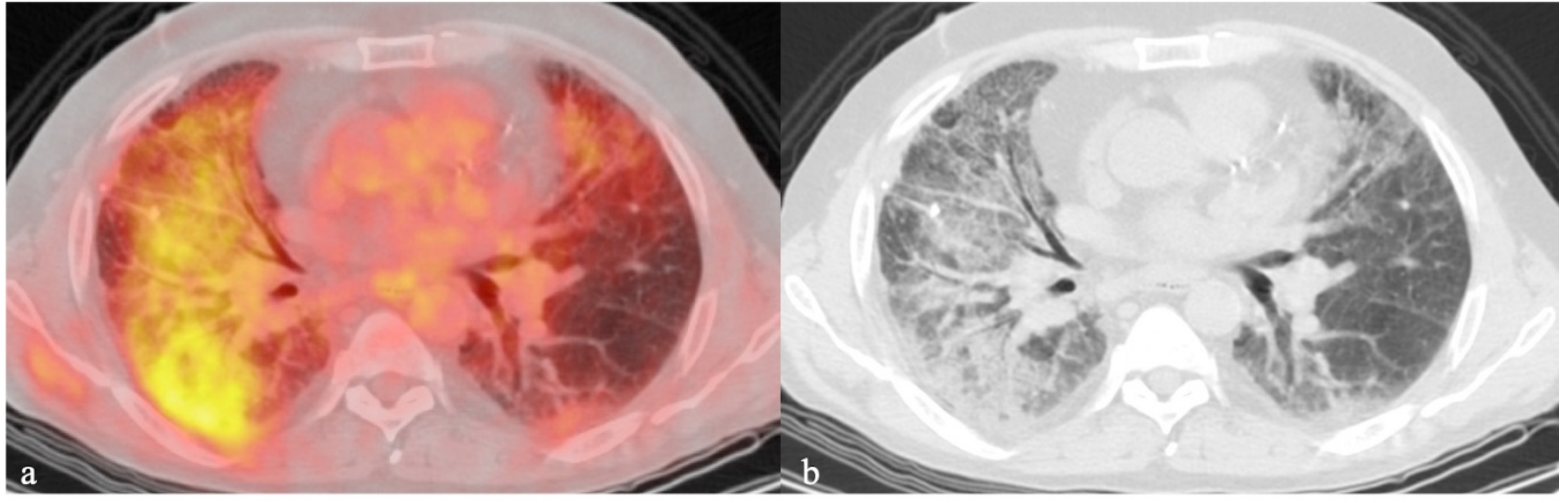 Ijms 21 00894 g002 Ijms 21 00894 g002