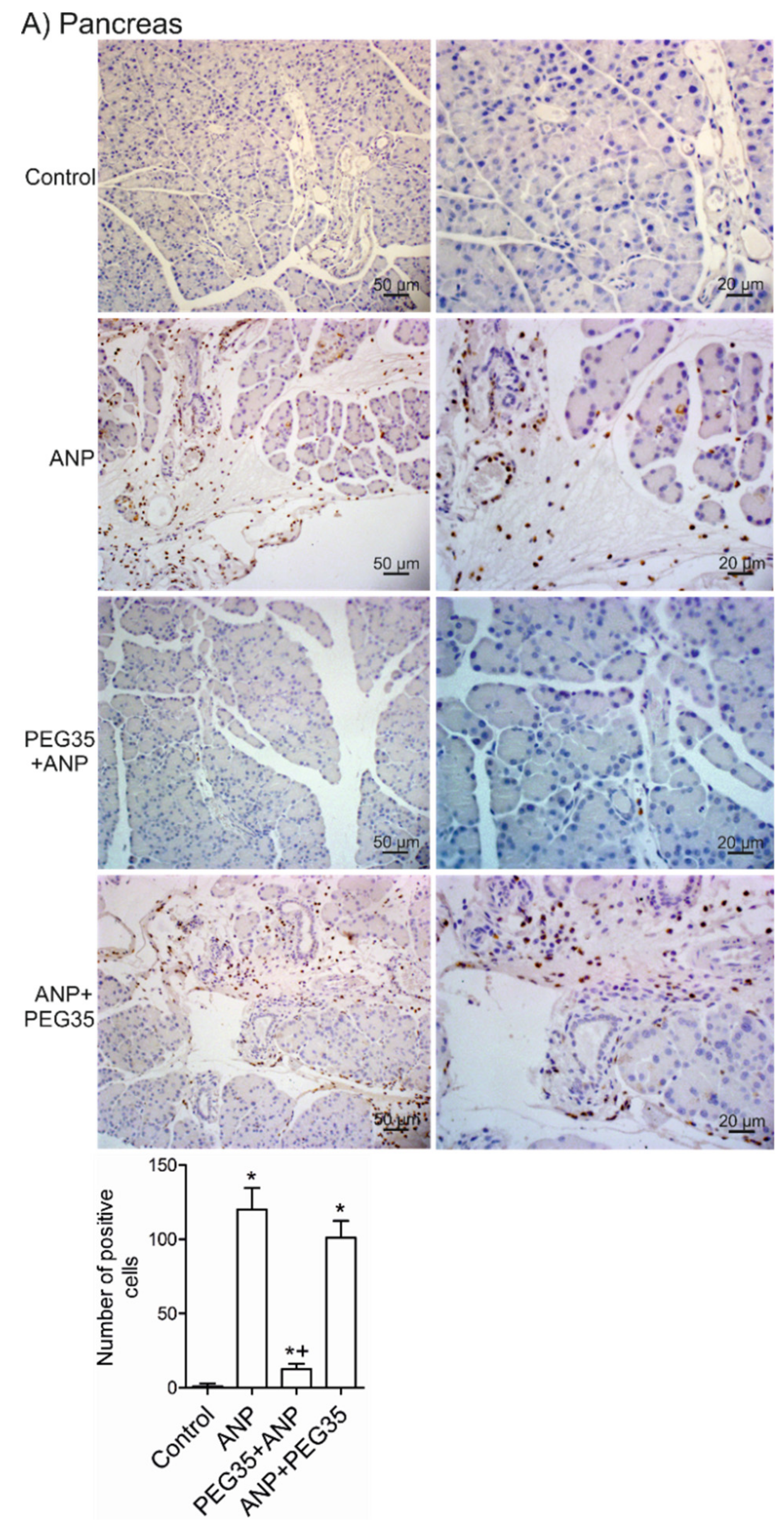 Ijms 21 00917 g005a Ijms 21 00917 g005a