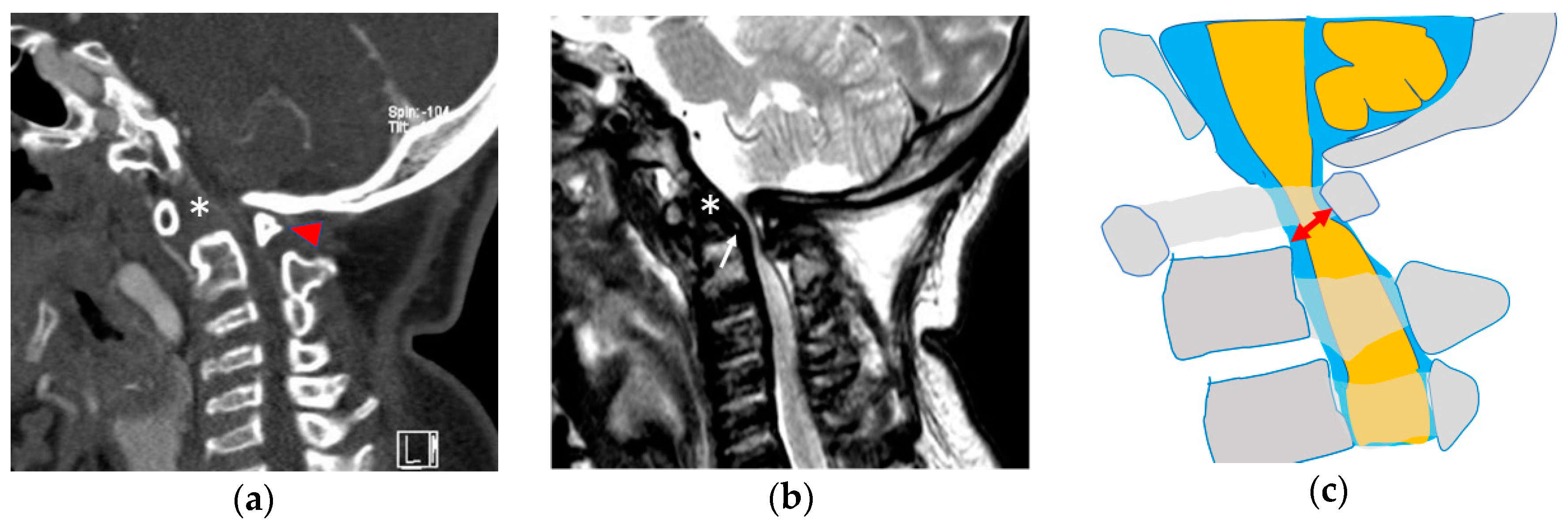 Ijms 21 01171 g002 Ijms 21 01171 g002