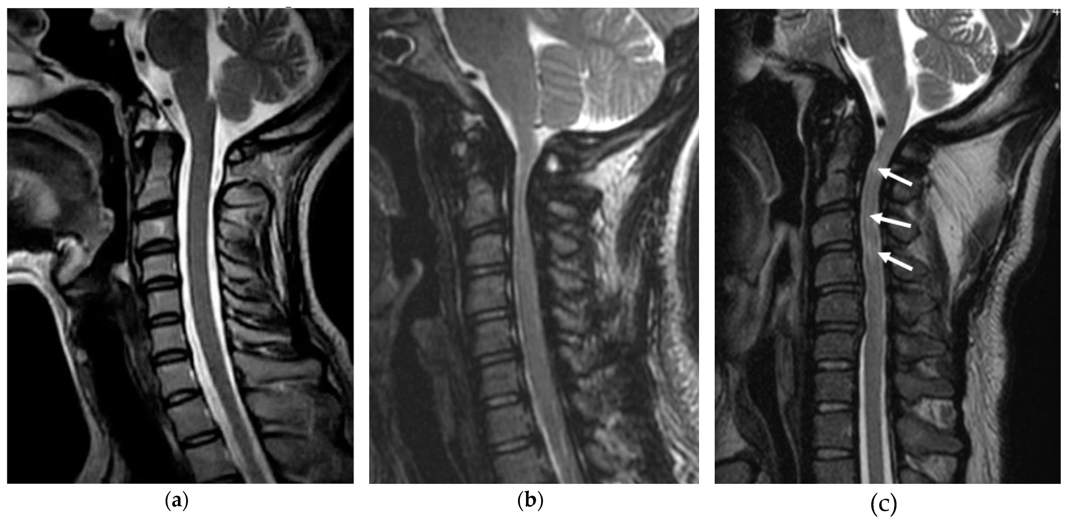 Ijms 21 01171 g004 Ijms 21 01171 g004