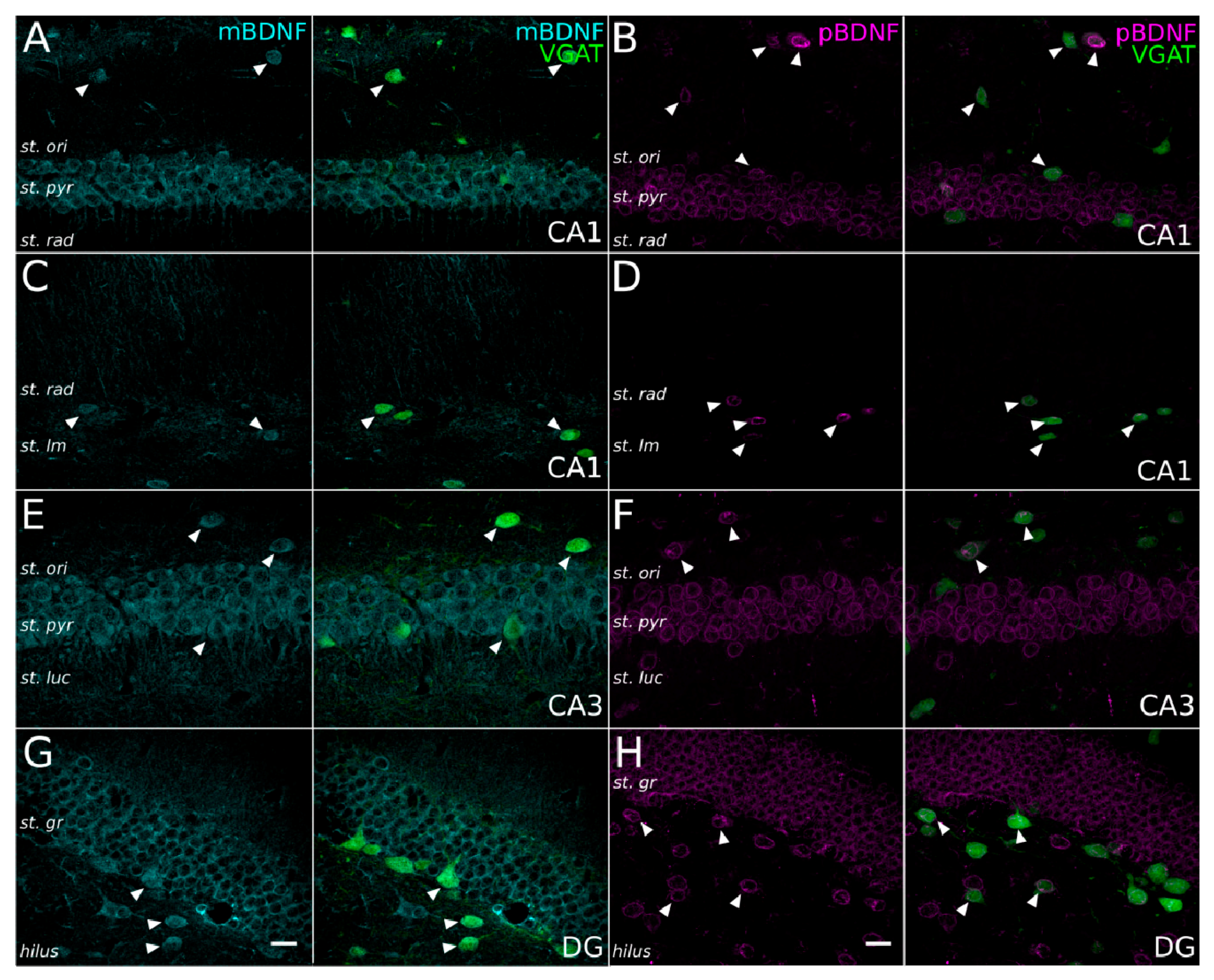 Ijms 21 01567 g004 Ijms 21 01567 g004