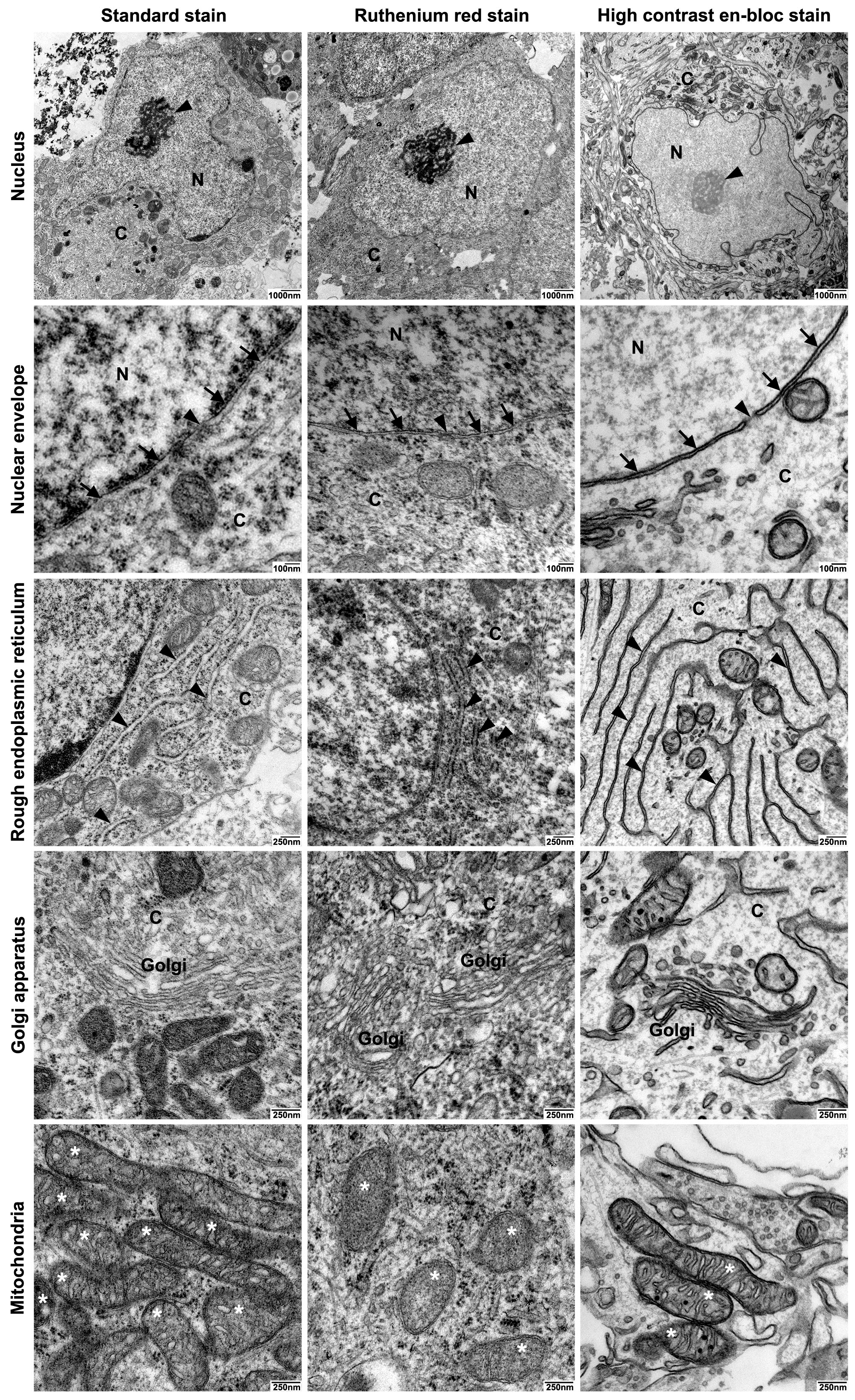 Ijms 21 01708 g003 Ijms 21 01708 g003