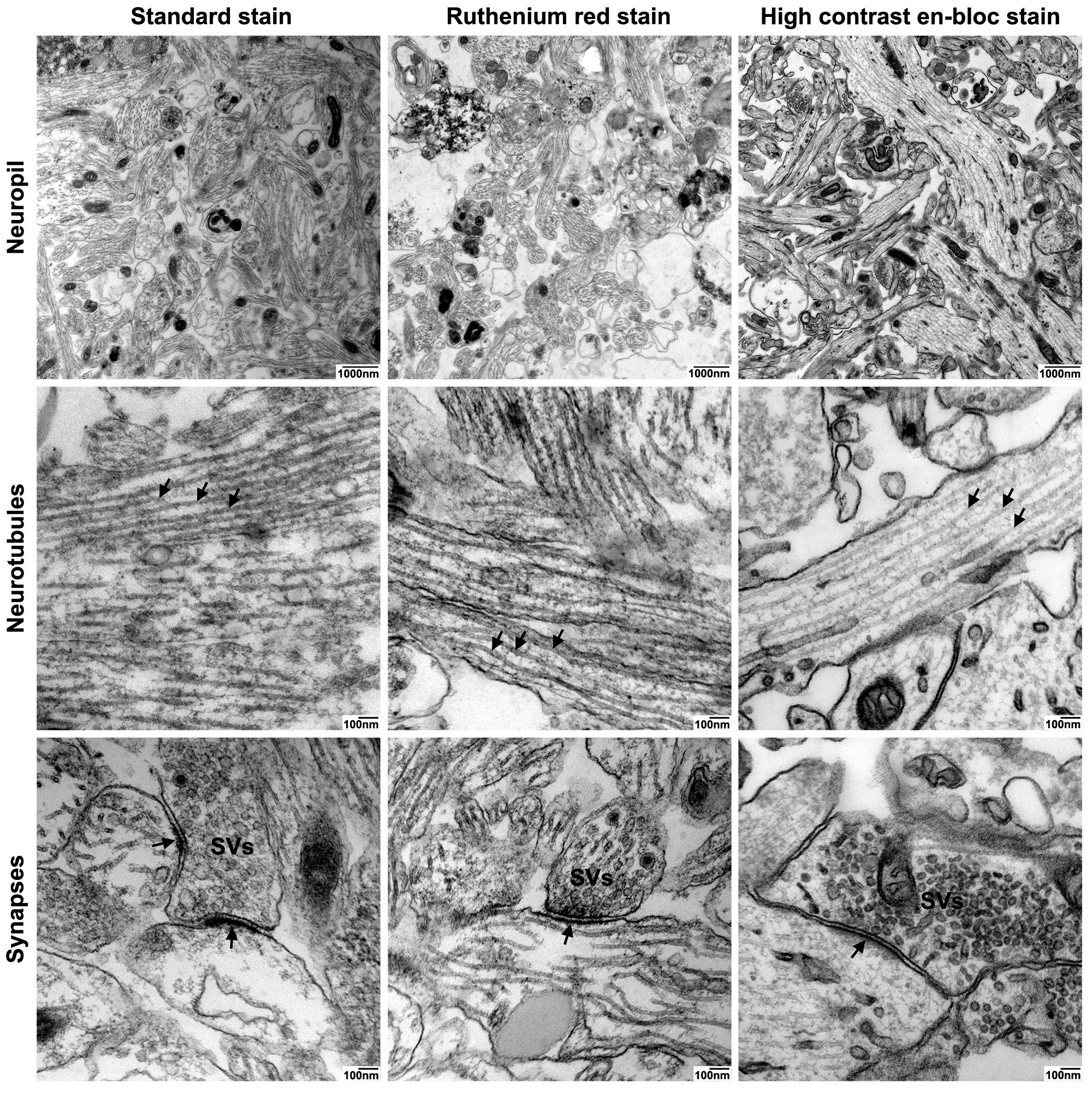 Ijms 21 01708 g004 Ijms 21 01708 g004