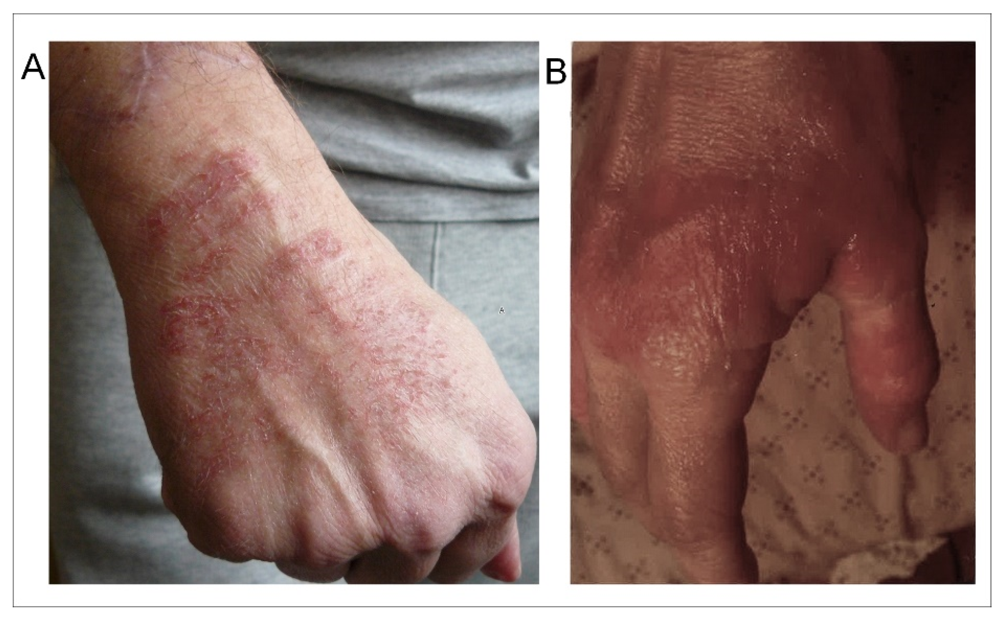 Ijms 21 01915 g001 Ijms 21 01915 g001