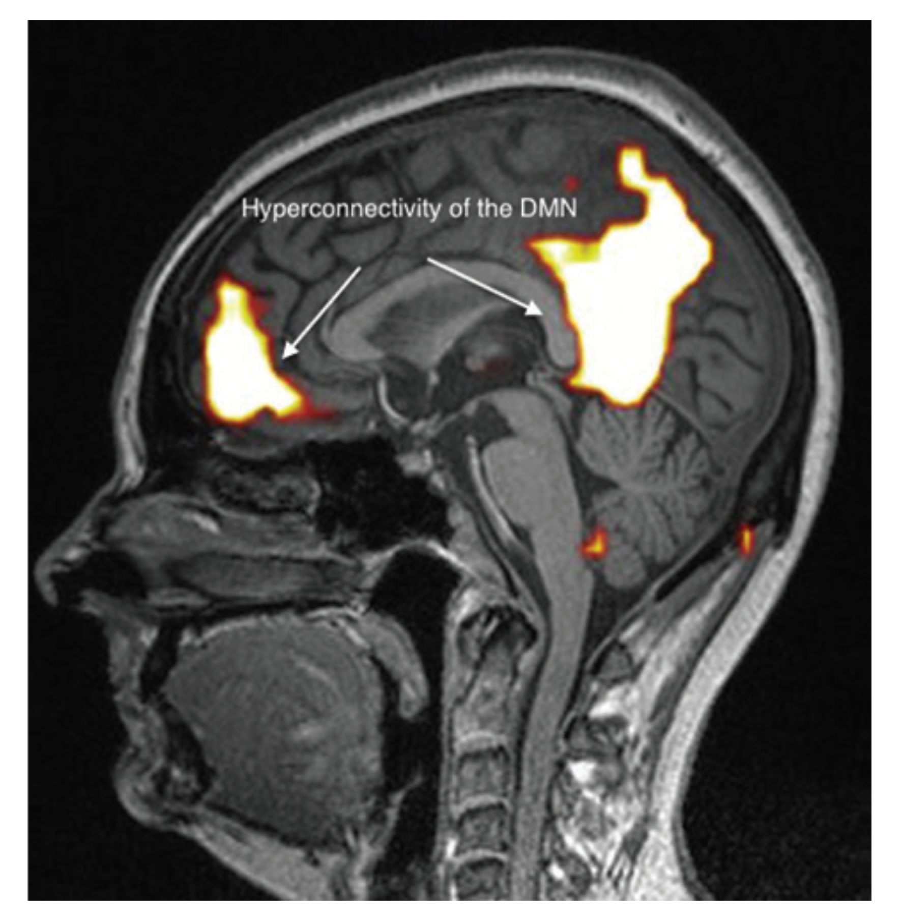 Ijms 21 01915 g004 Ijms 21 01915 g004