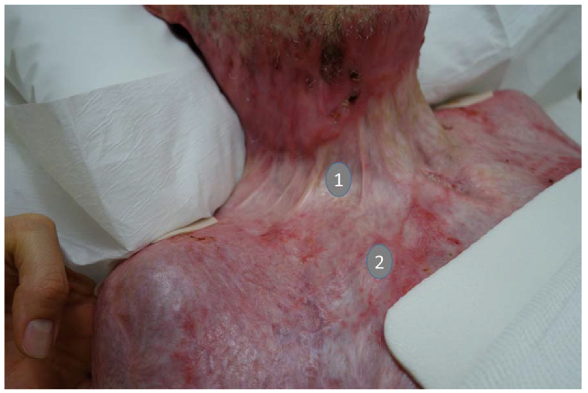 Ijms 21 02055 g002 Ijms 21 02055 g002