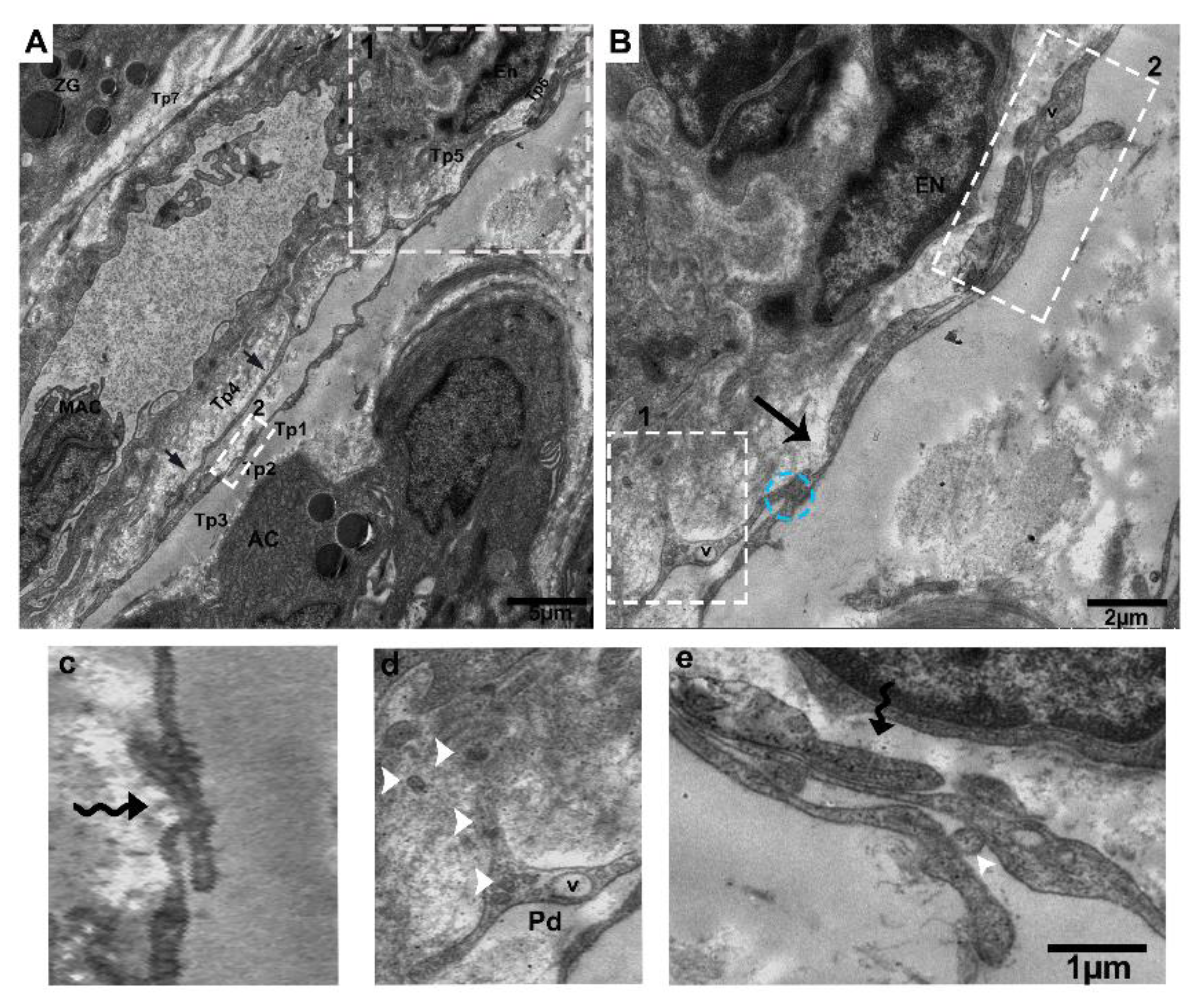 Ijms 21 02057 g004 Ijms 21 02057 g004