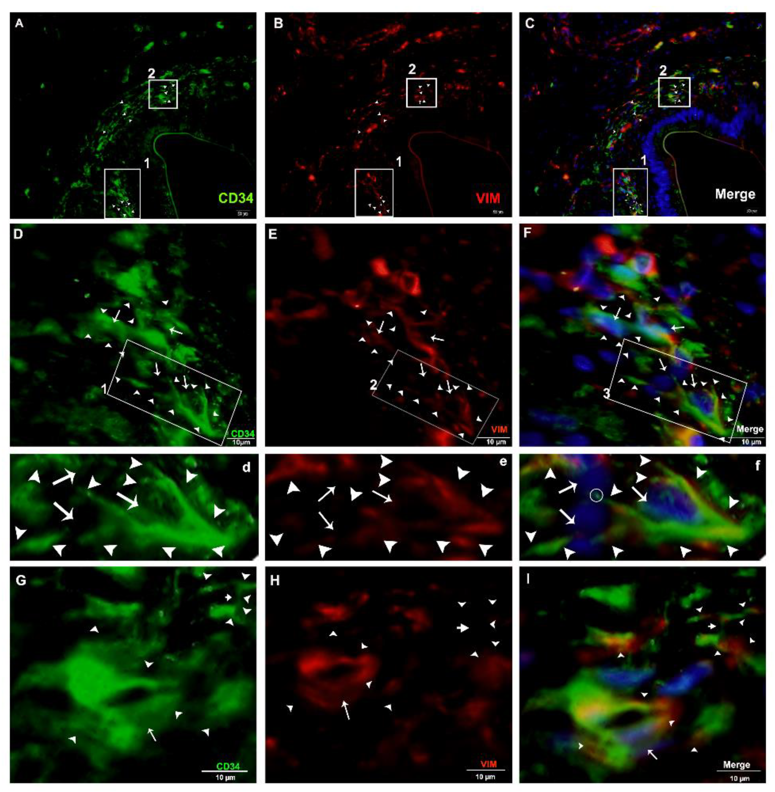 Ijms 21 02057 g011 Ijms 21 02057 g011