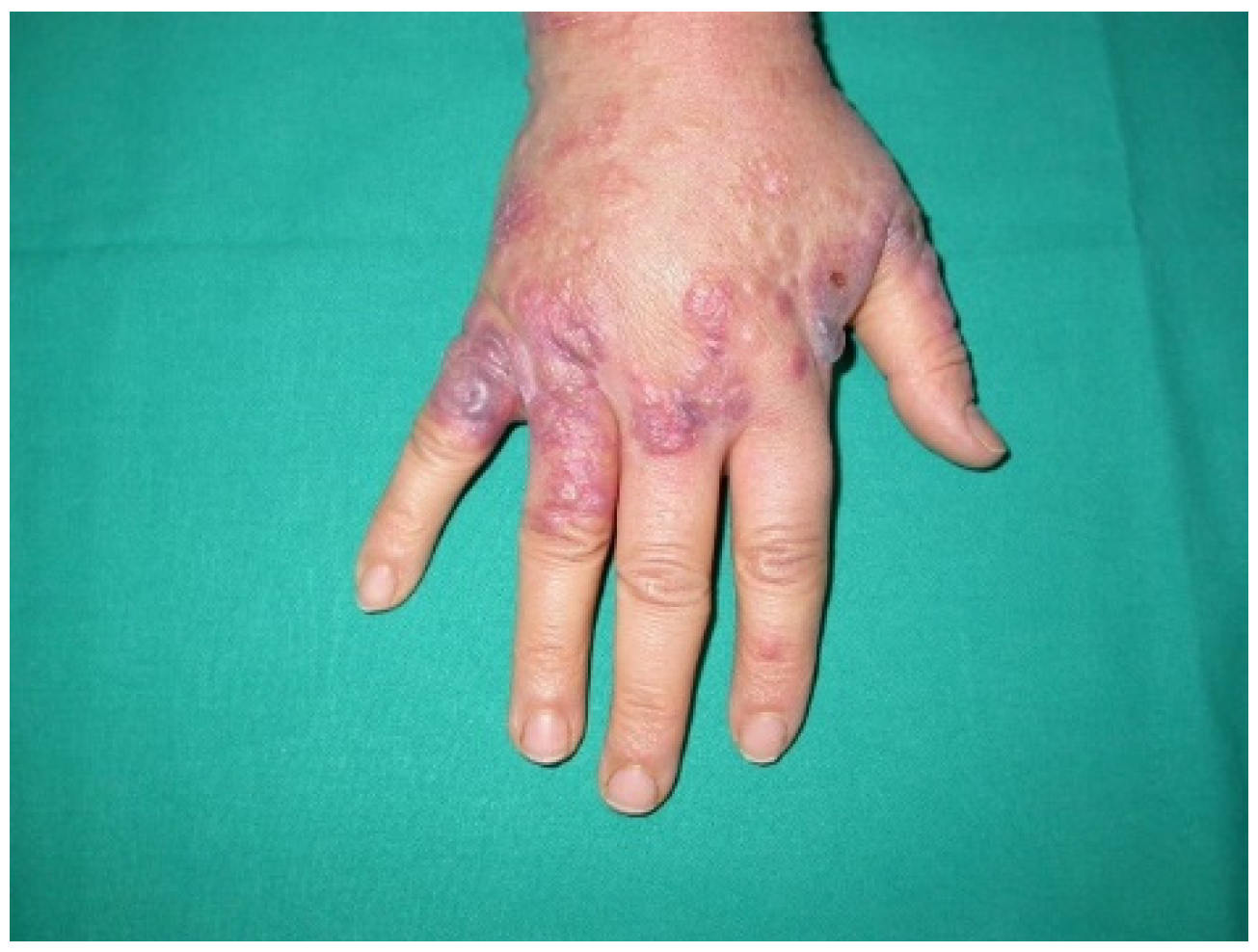 Ijms 21 02178 g002 Ijms 21 02178 g002