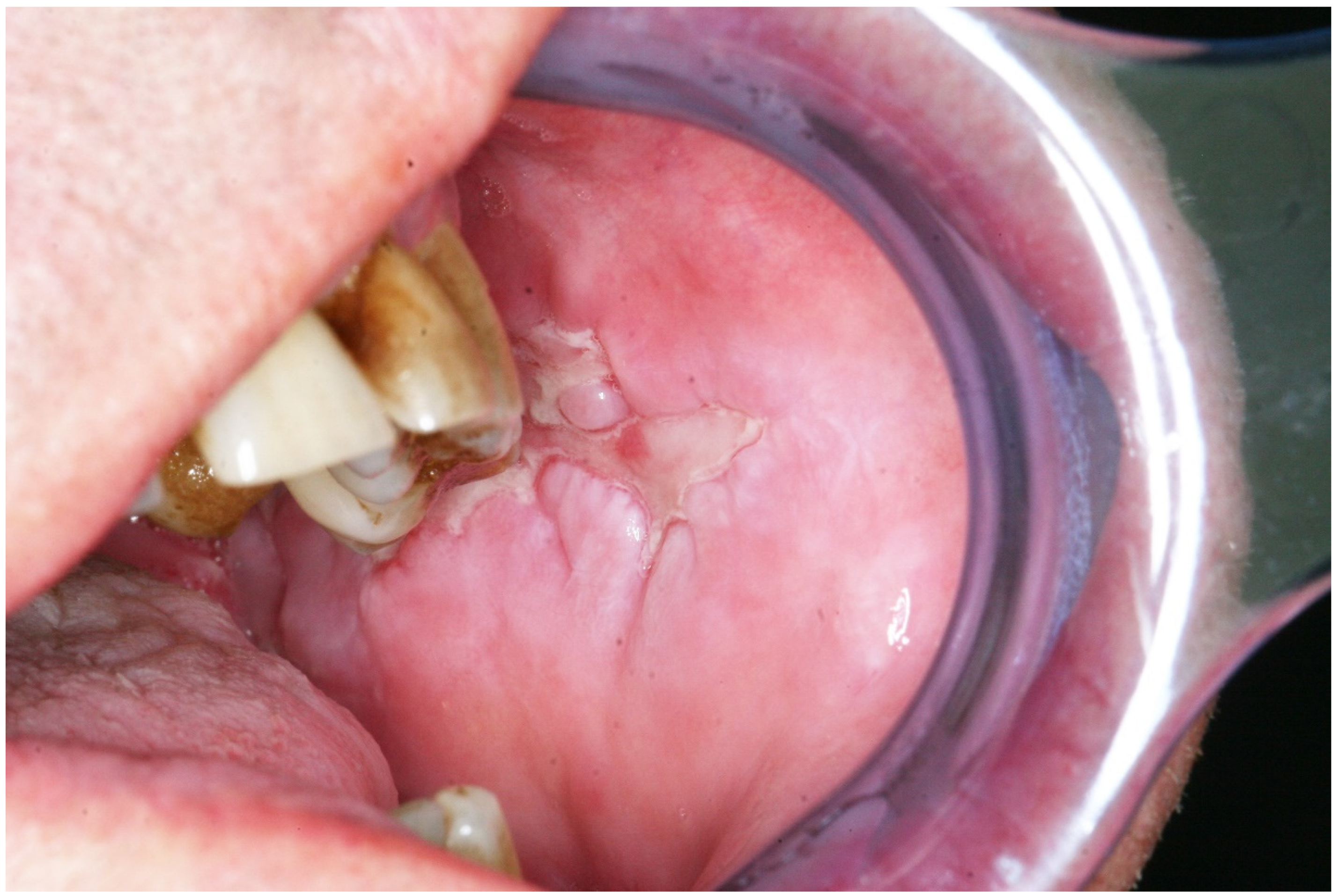 Ijms 21 02178 g003 Ijms 21 02178 g003