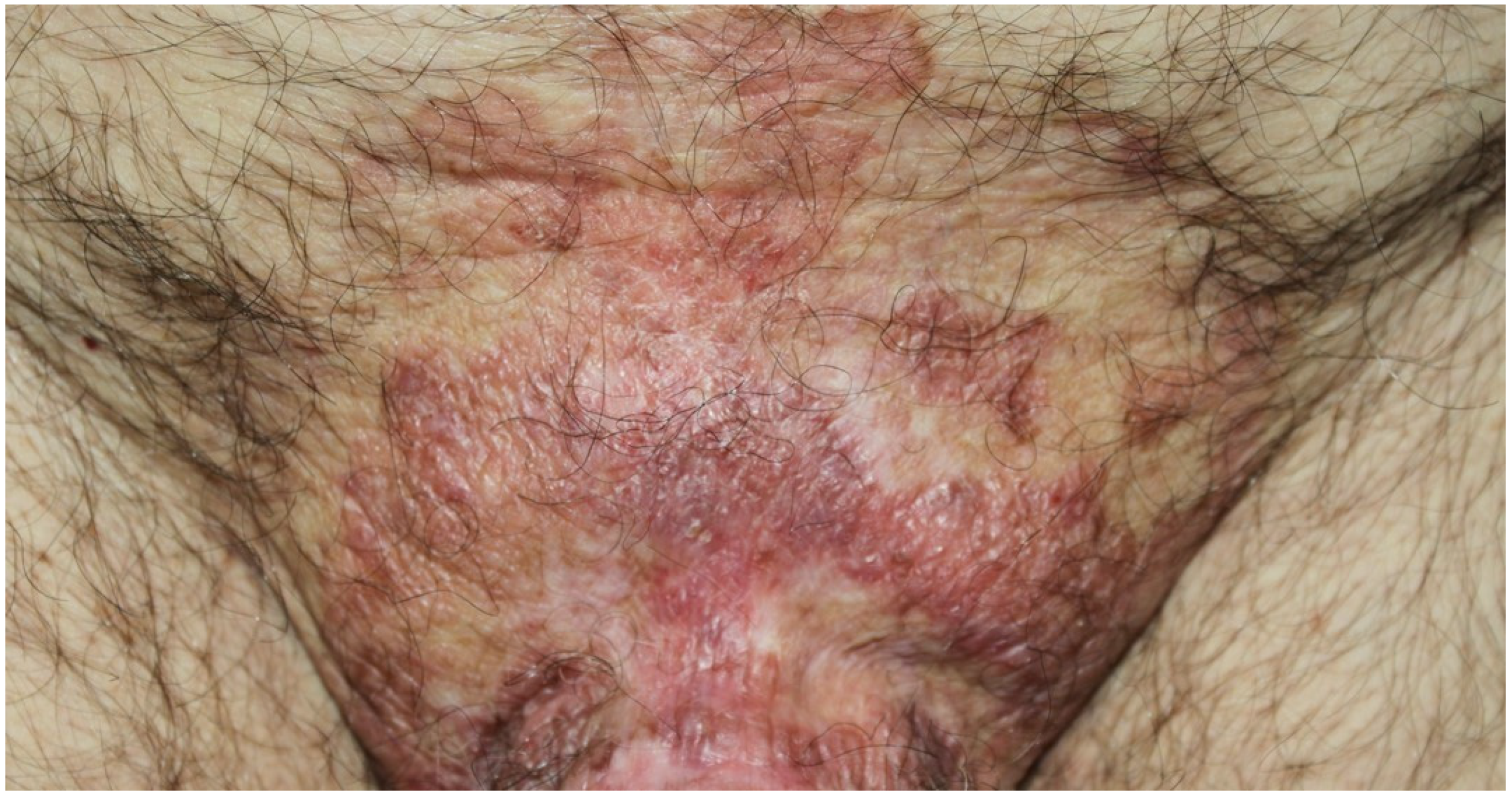 Ijms 21 02178 g004 Ijms 21 02178 g004