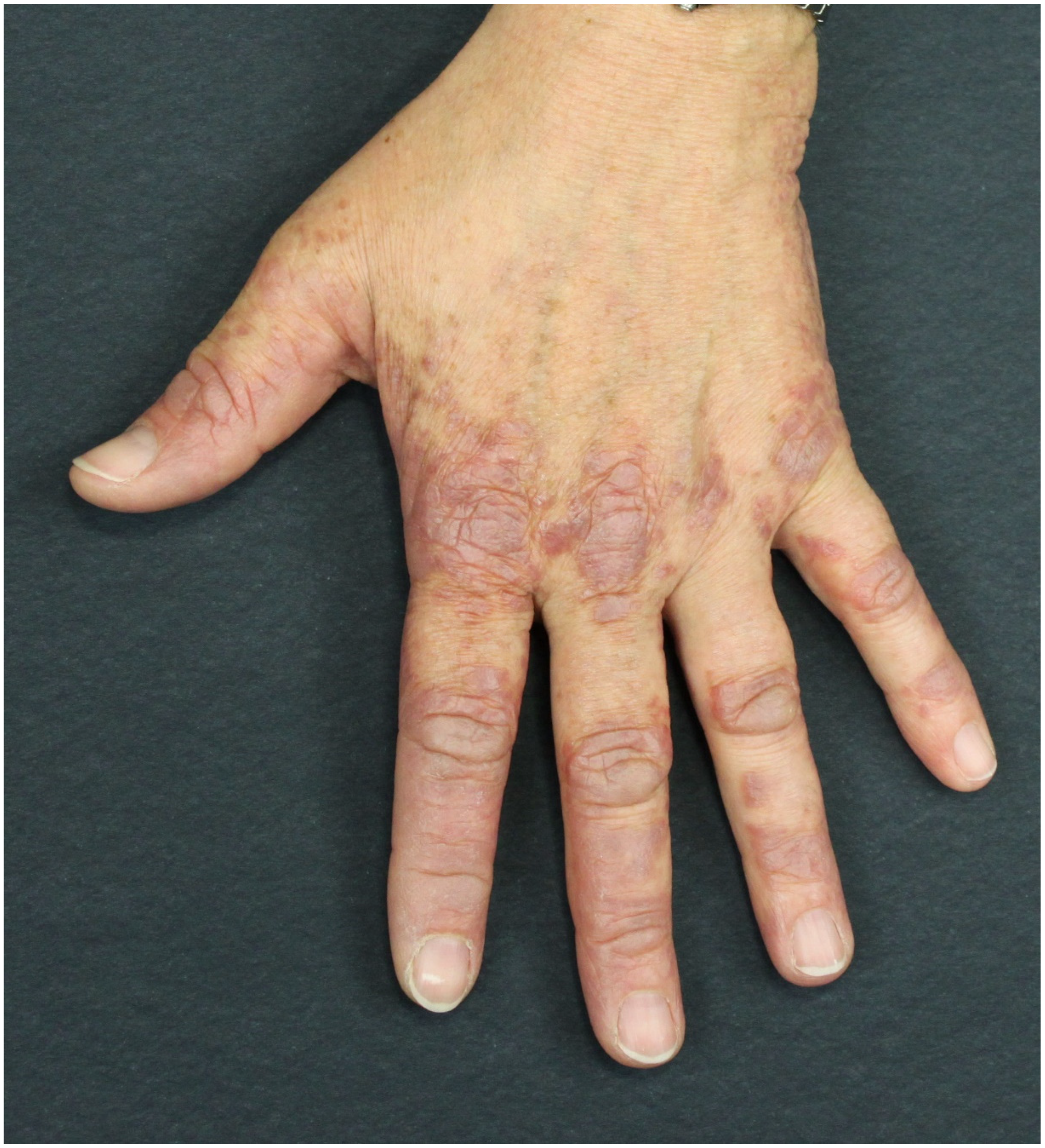 Ijms 21 02178 g005 Ijms 21 02178 g005