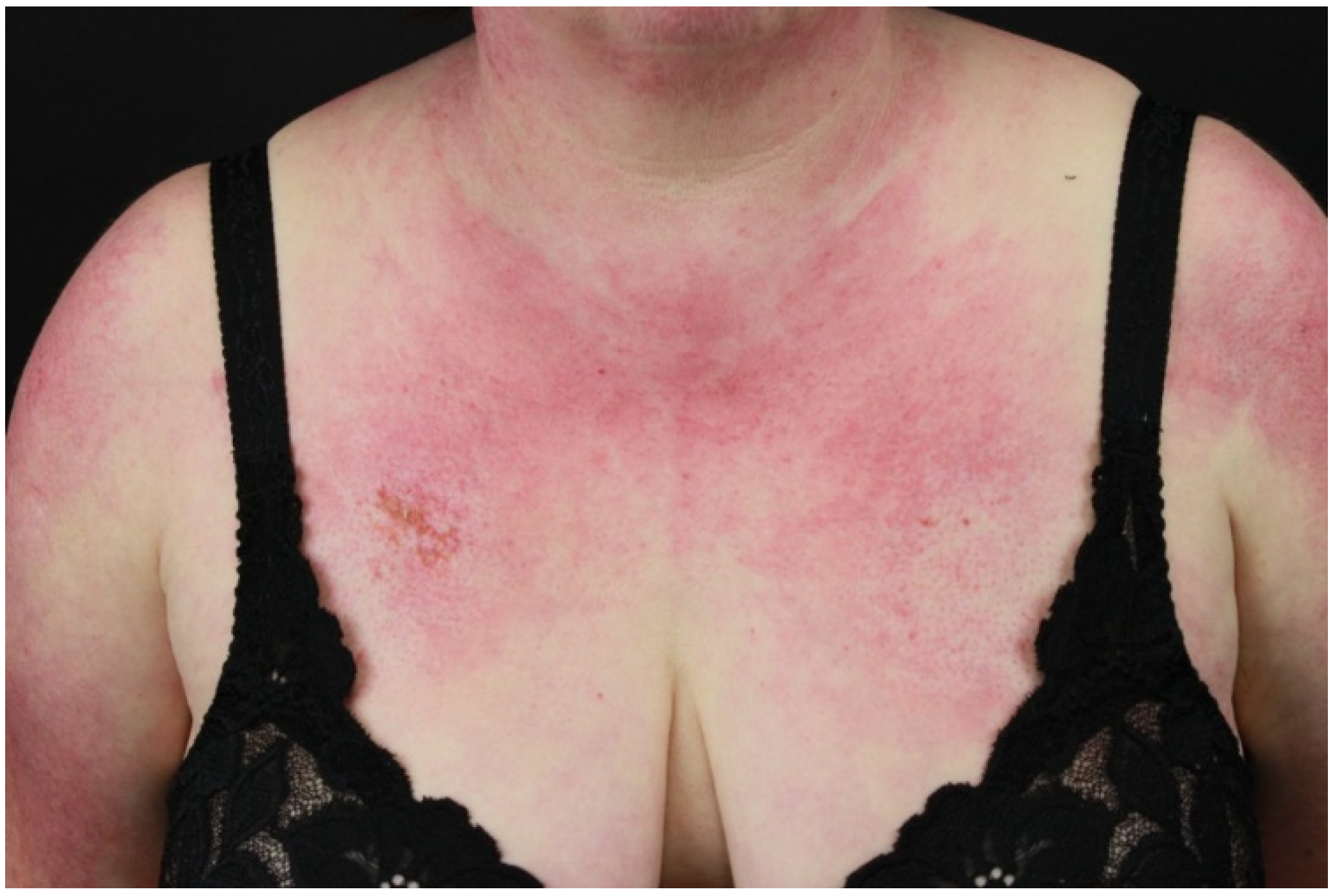 Ijms 21 02178 g006 Ijms 21 02178 g006