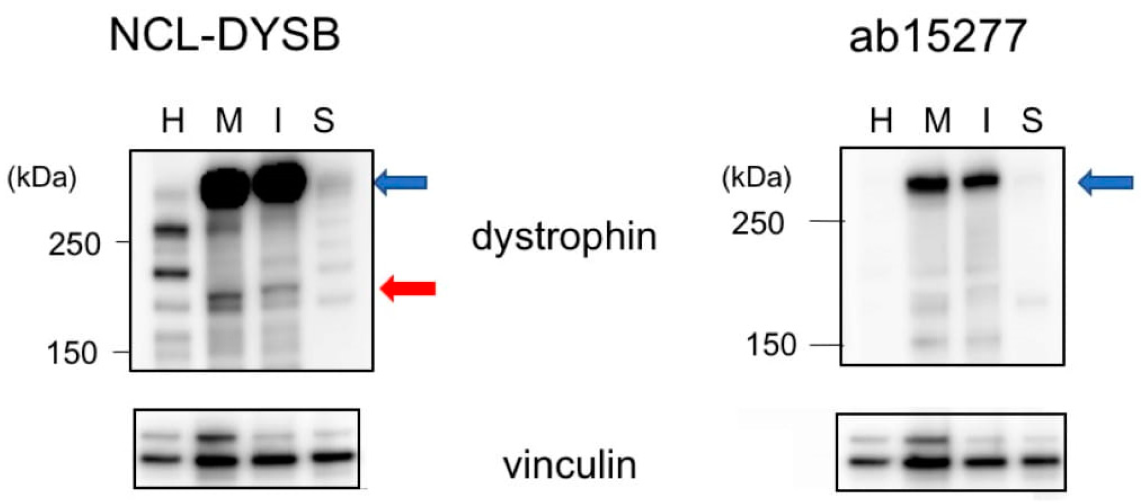 Ijms 21 03555 g004 Ijms 21 03555 g004