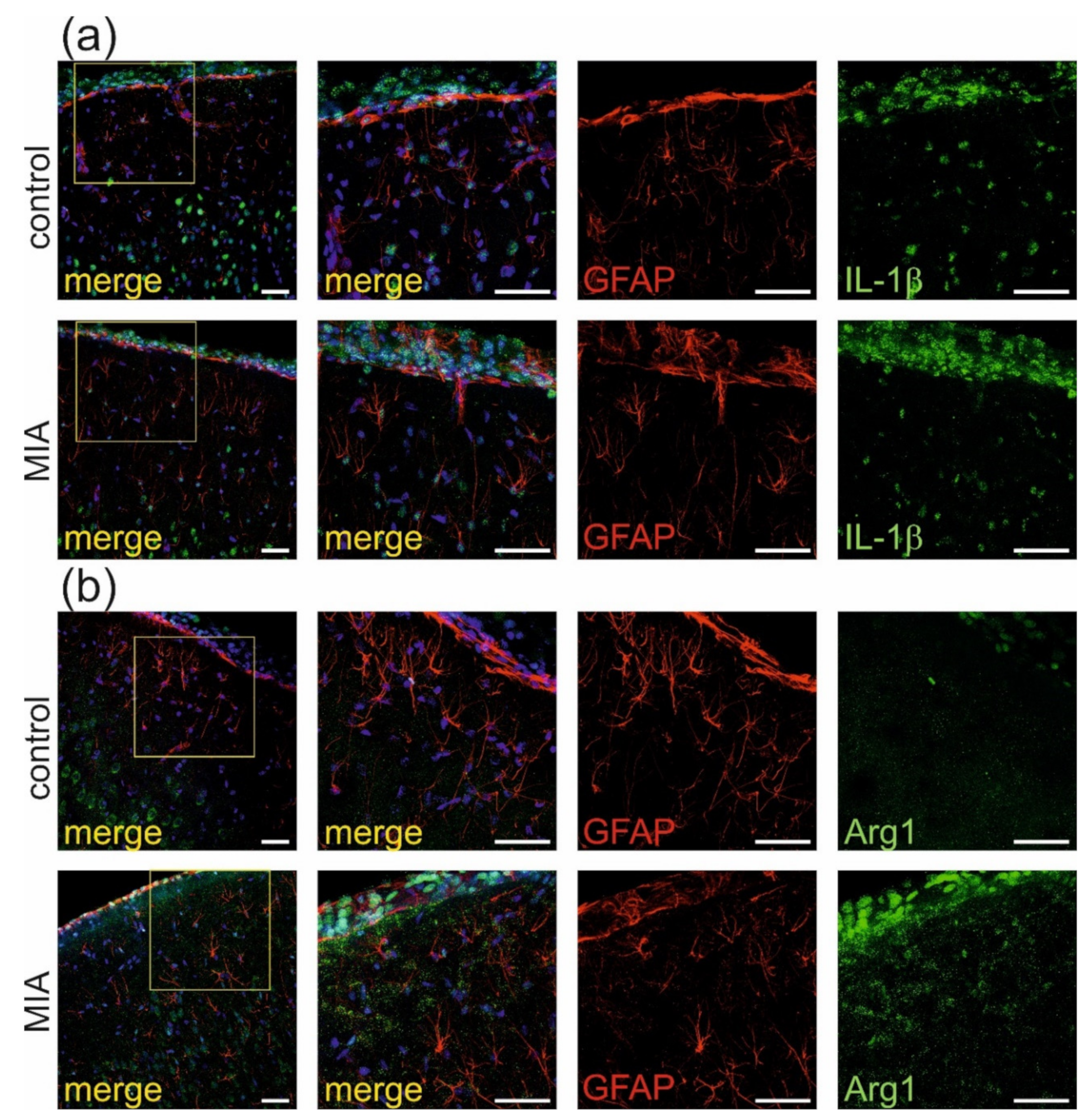 Ijms 21 04097 g007 Ijms 21 04097 g007