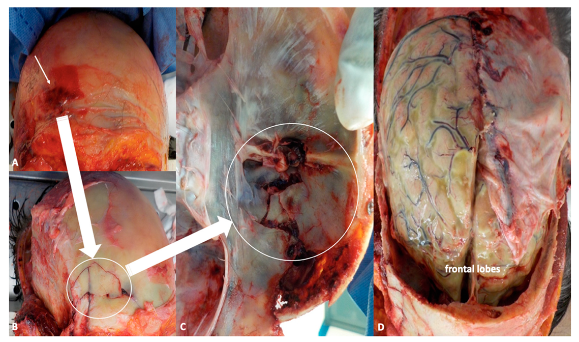 Ijms 21 04148 g002 Ijms 21 04148 g002