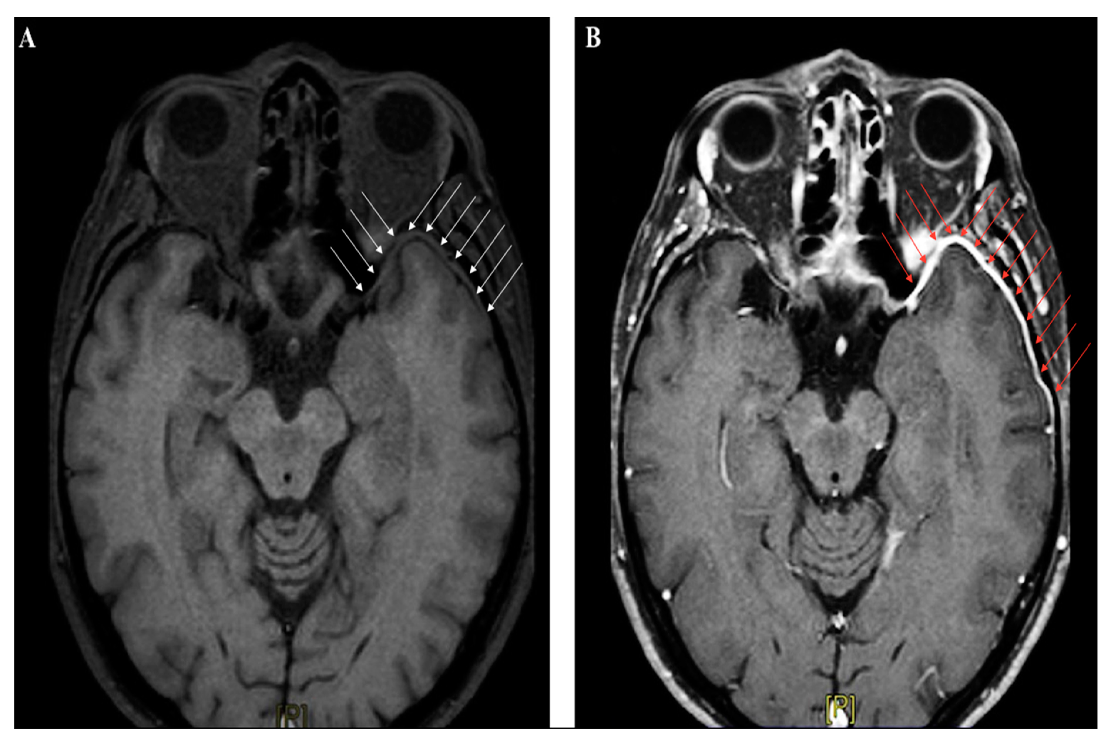 Ijms 21 04148 g003 Ijms 21 04148 g003