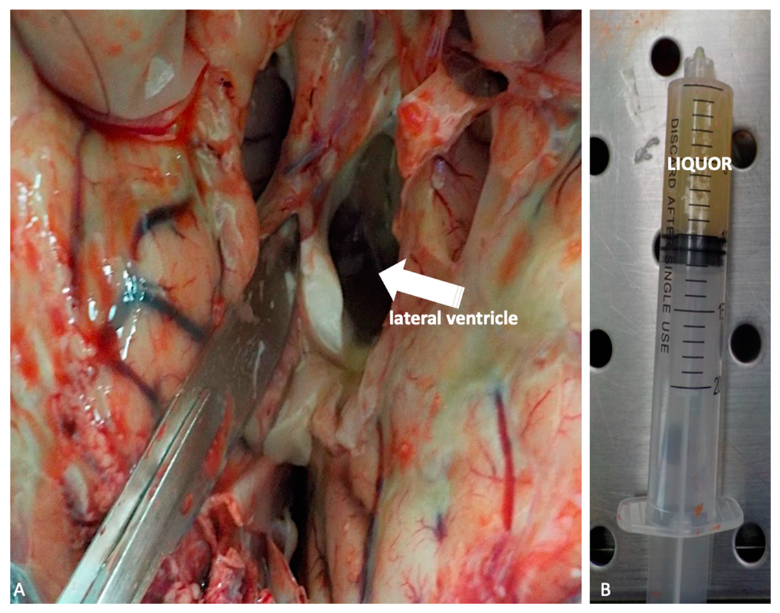 Ijms 21 04148 g004 Ijms 21 04148 g004