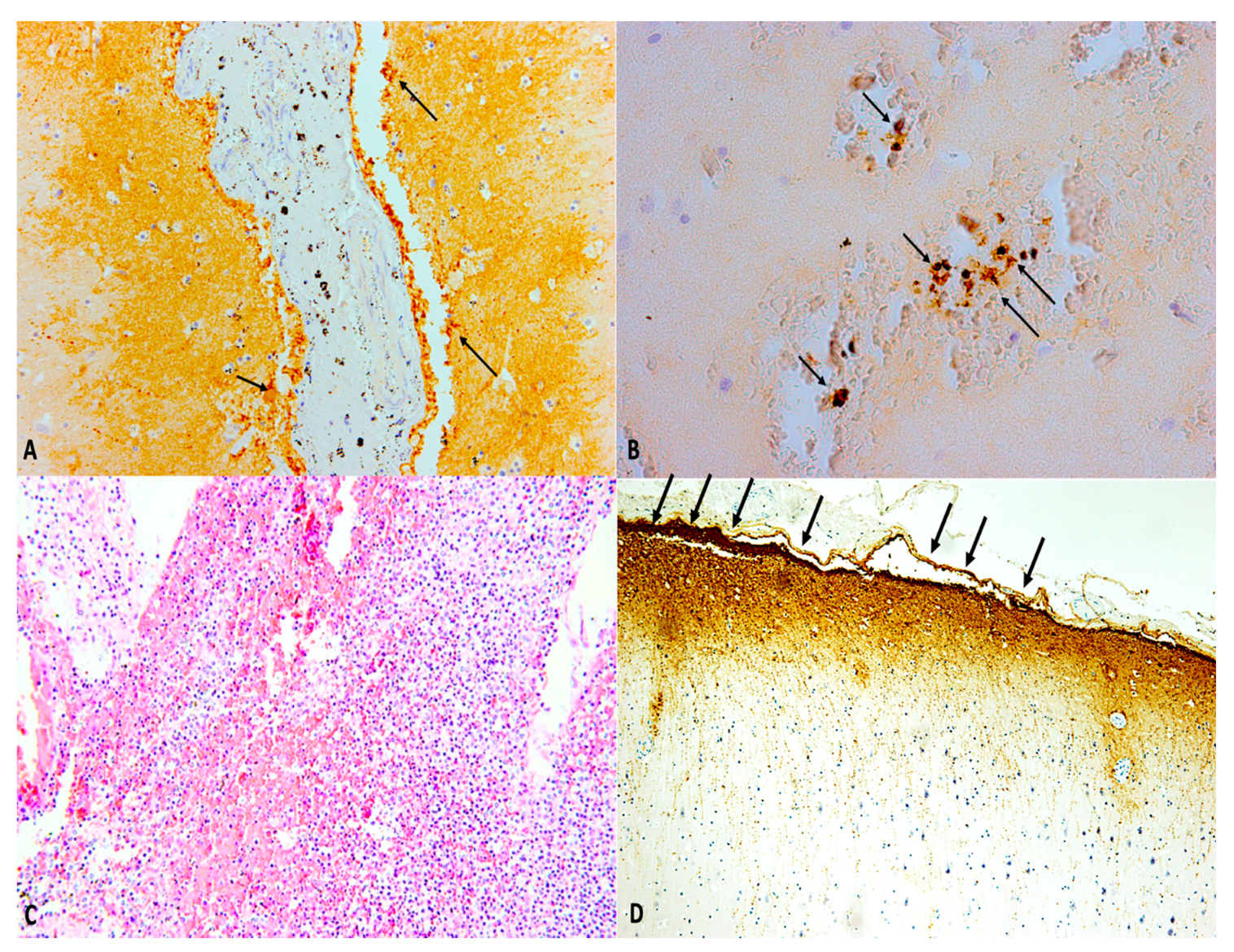 Ijms 21 04148 g006 Ijms 21 04148 g006