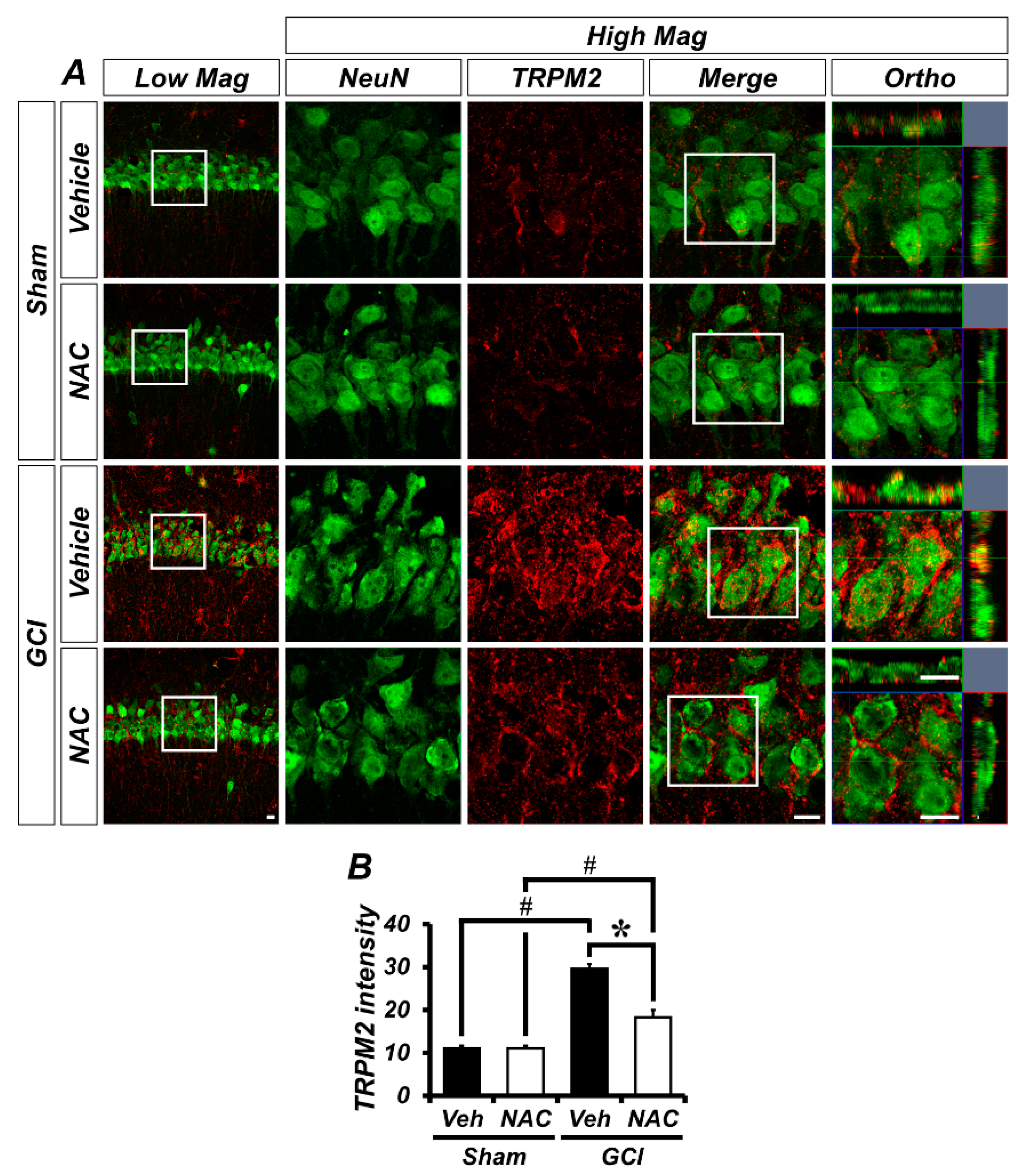Ijms 21 06026 g004 Ijms 21 06026 g004