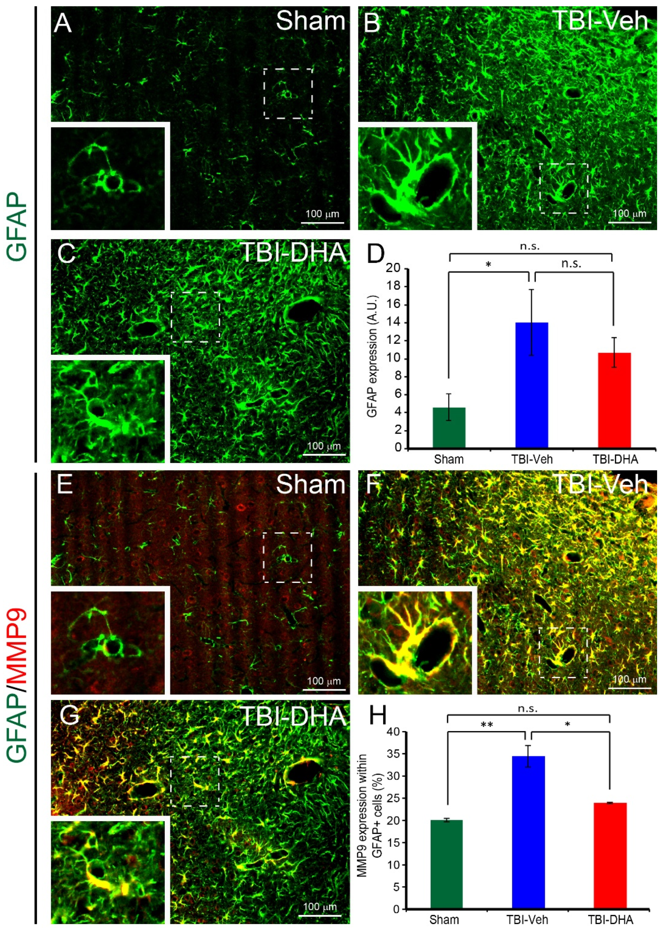 Ijms 21 06291 g006 Ijms 21 06291 g006