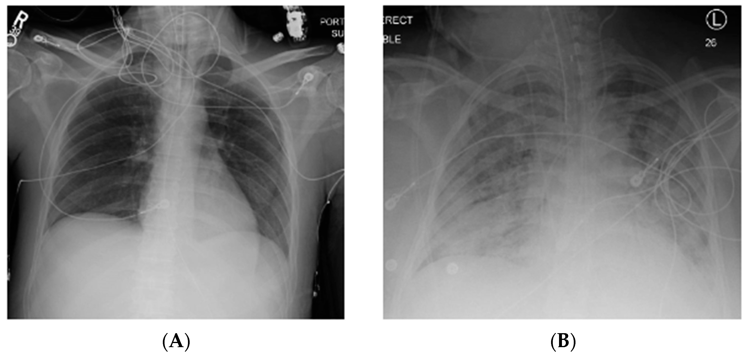 Ijms 21 06820 g001 Ijms 21 06820 g001