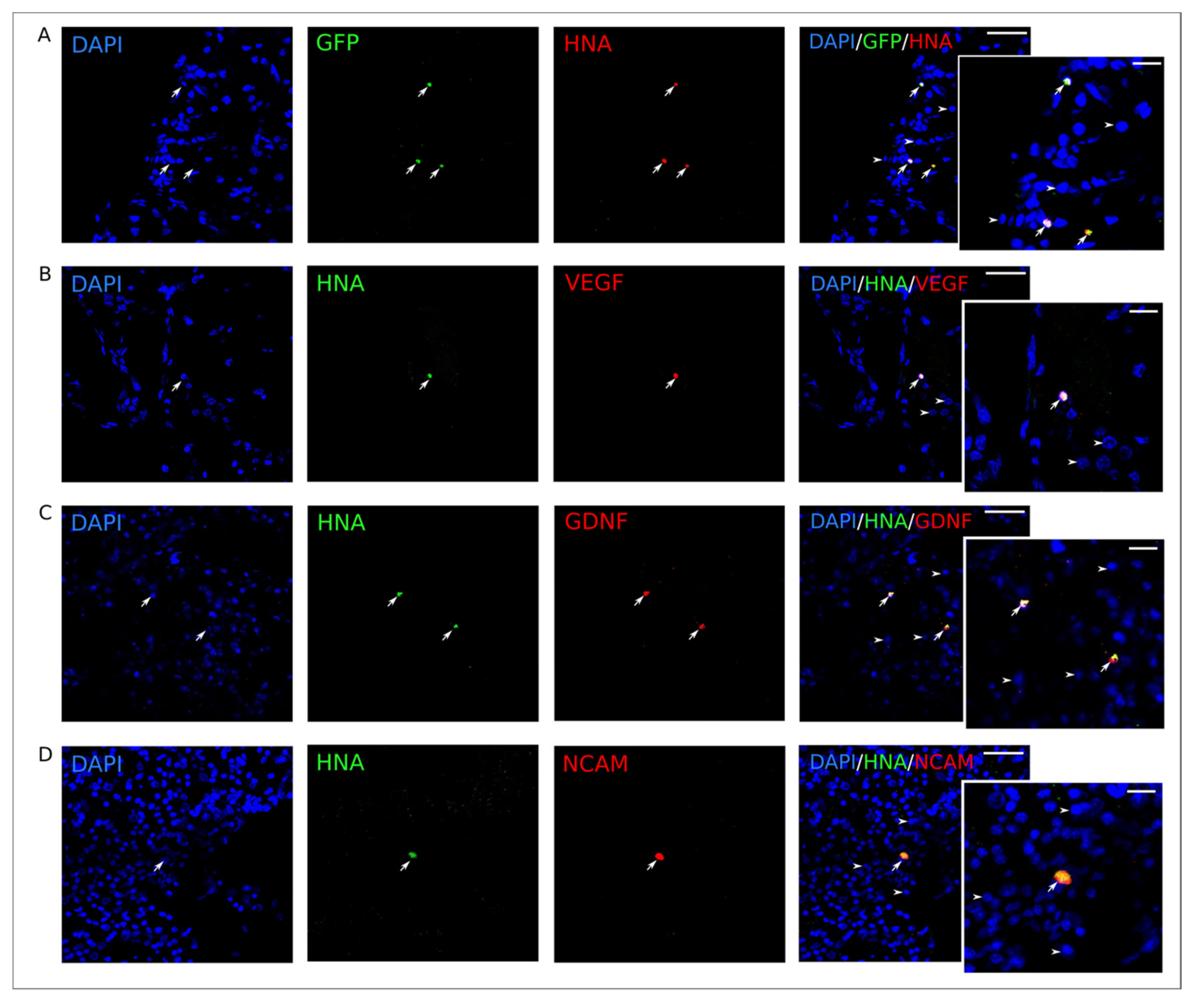 Ijms 21 06858 g011 Ijms 21 06858 g011