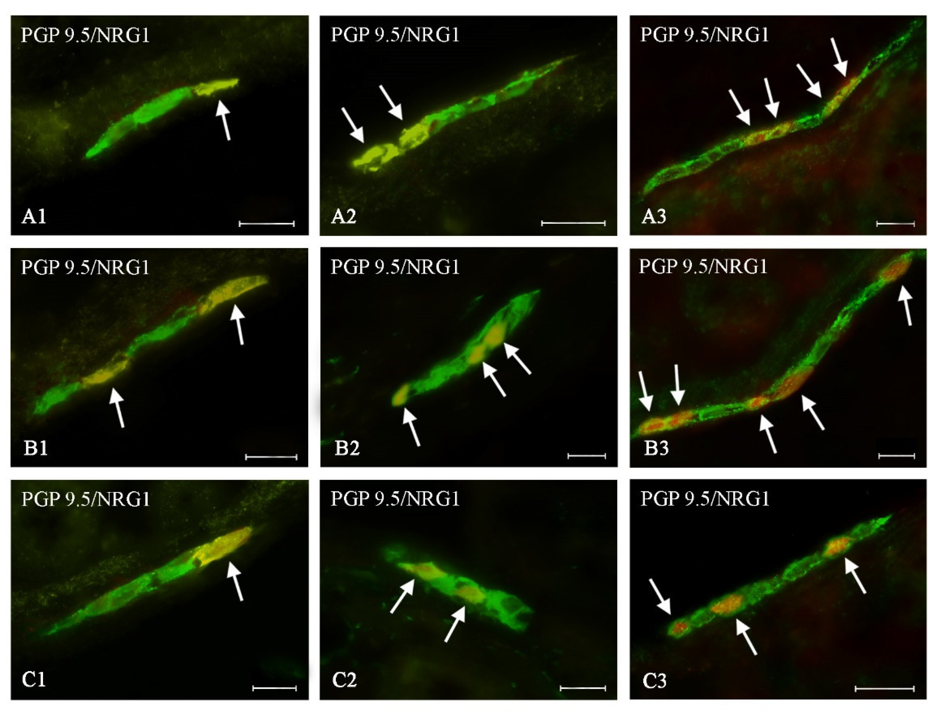 Ijms 21 08743 g004 Ijms 21 08743 g004