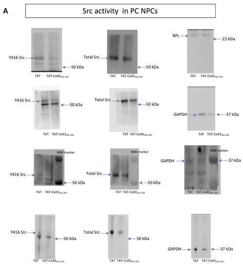 Ijms 21 08852 g0a1a Ijms 21 08852 g0a1a