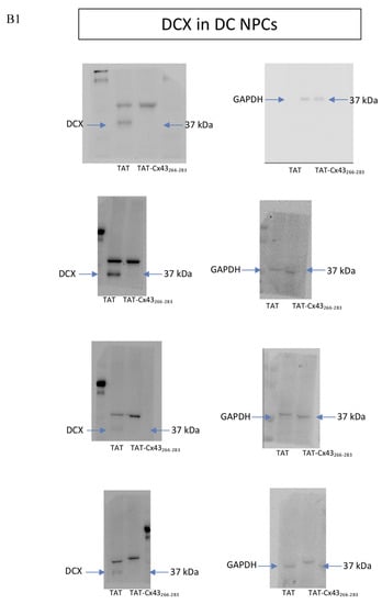 Ijms 21 08852 g0a1b Ijms 21 08852 g0a1b