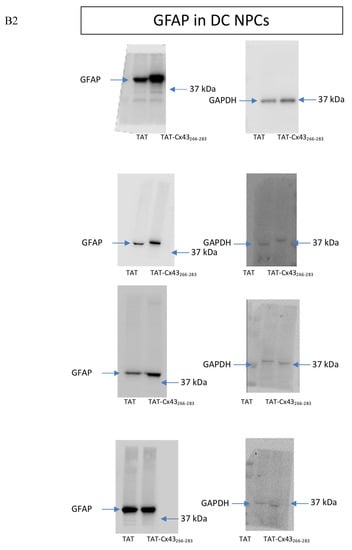 Ijms 21 08852 g0a1c Ijms 21 08852 g0a1c