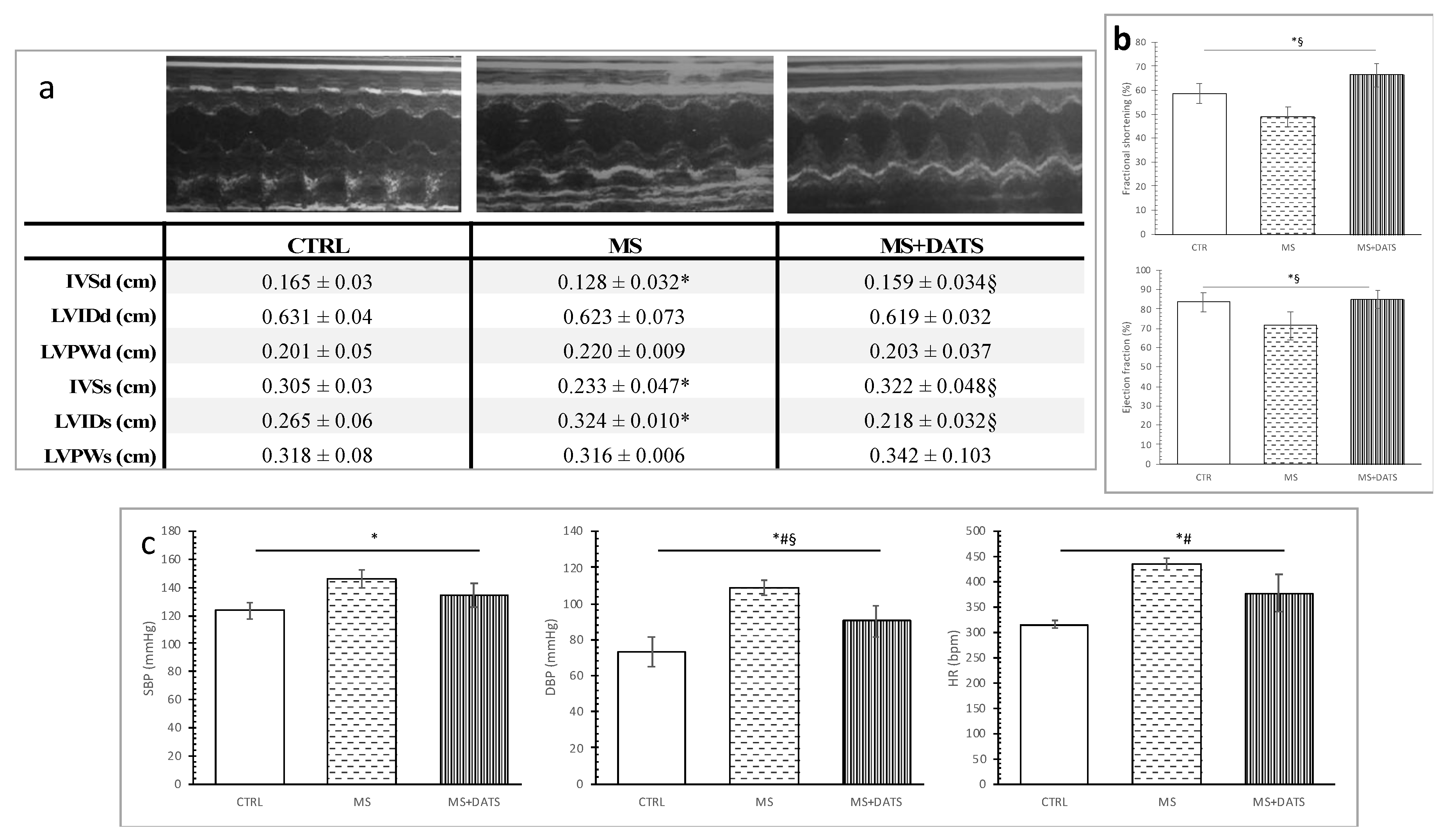 Ijms 21 09100 g004 Ijms 21 09100 g004