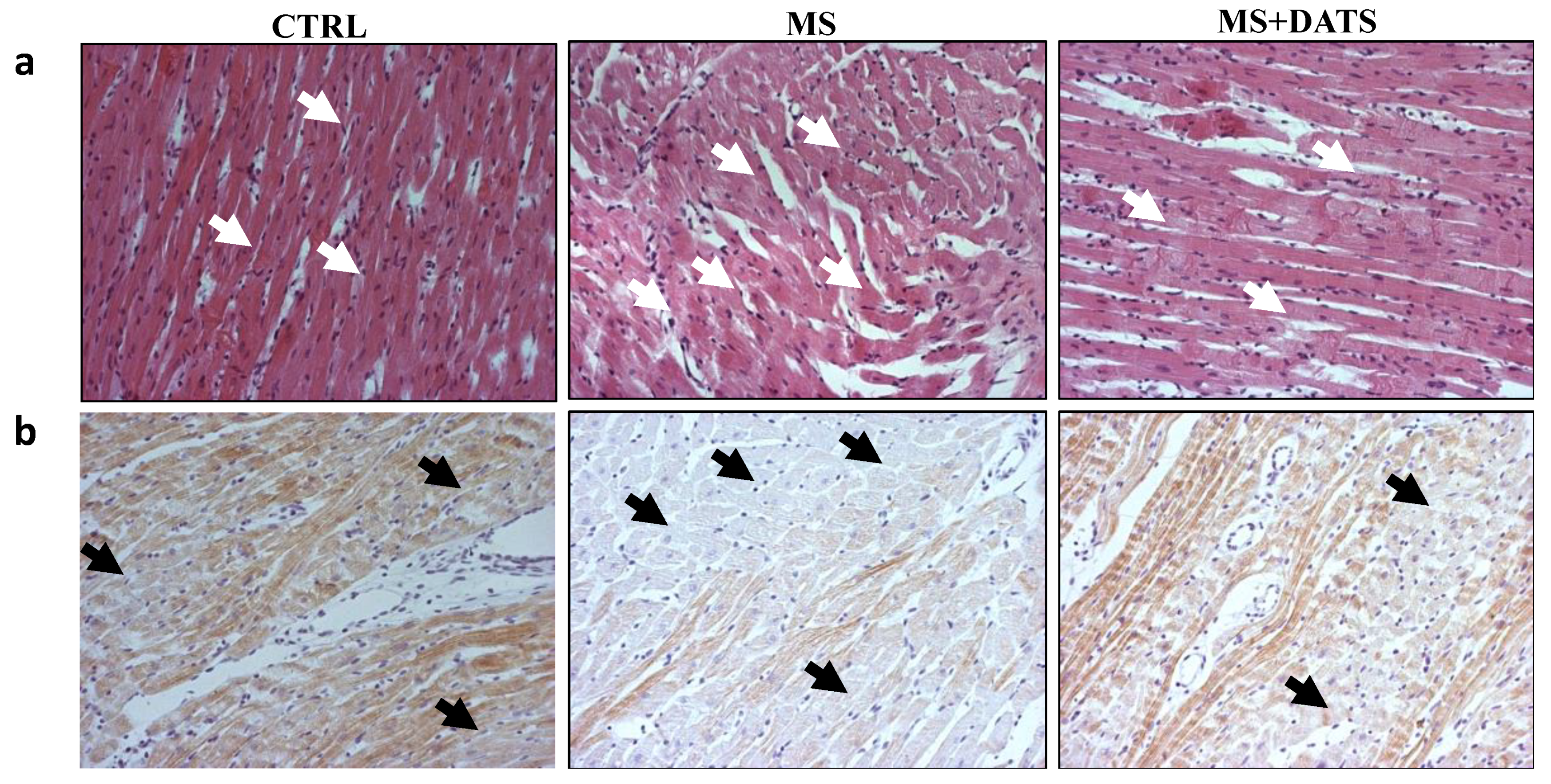 Ijms 21 09100 g006 Ijms 21 09100 g006