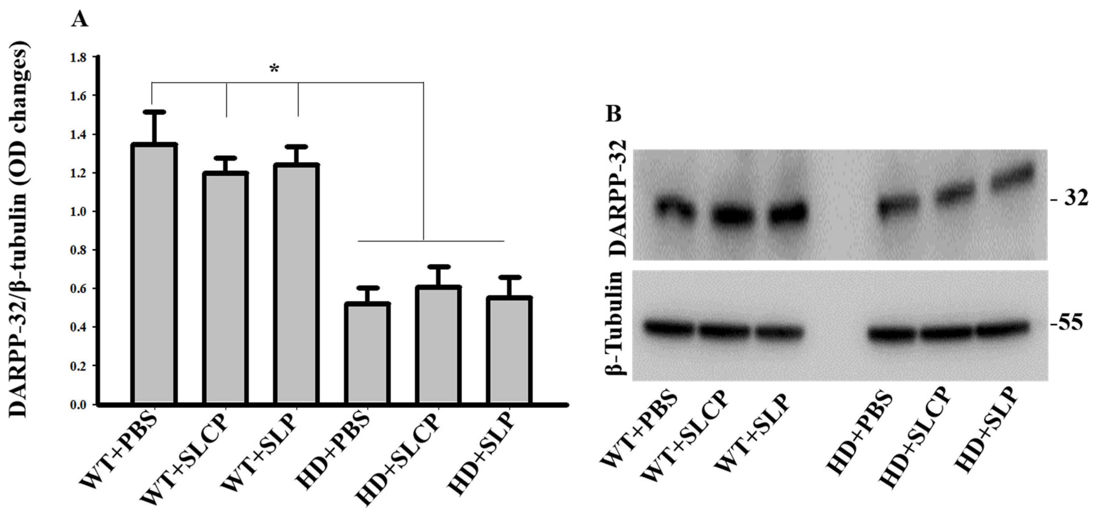 Ijms 21 09542 g004 Ijms 21 09542 g004