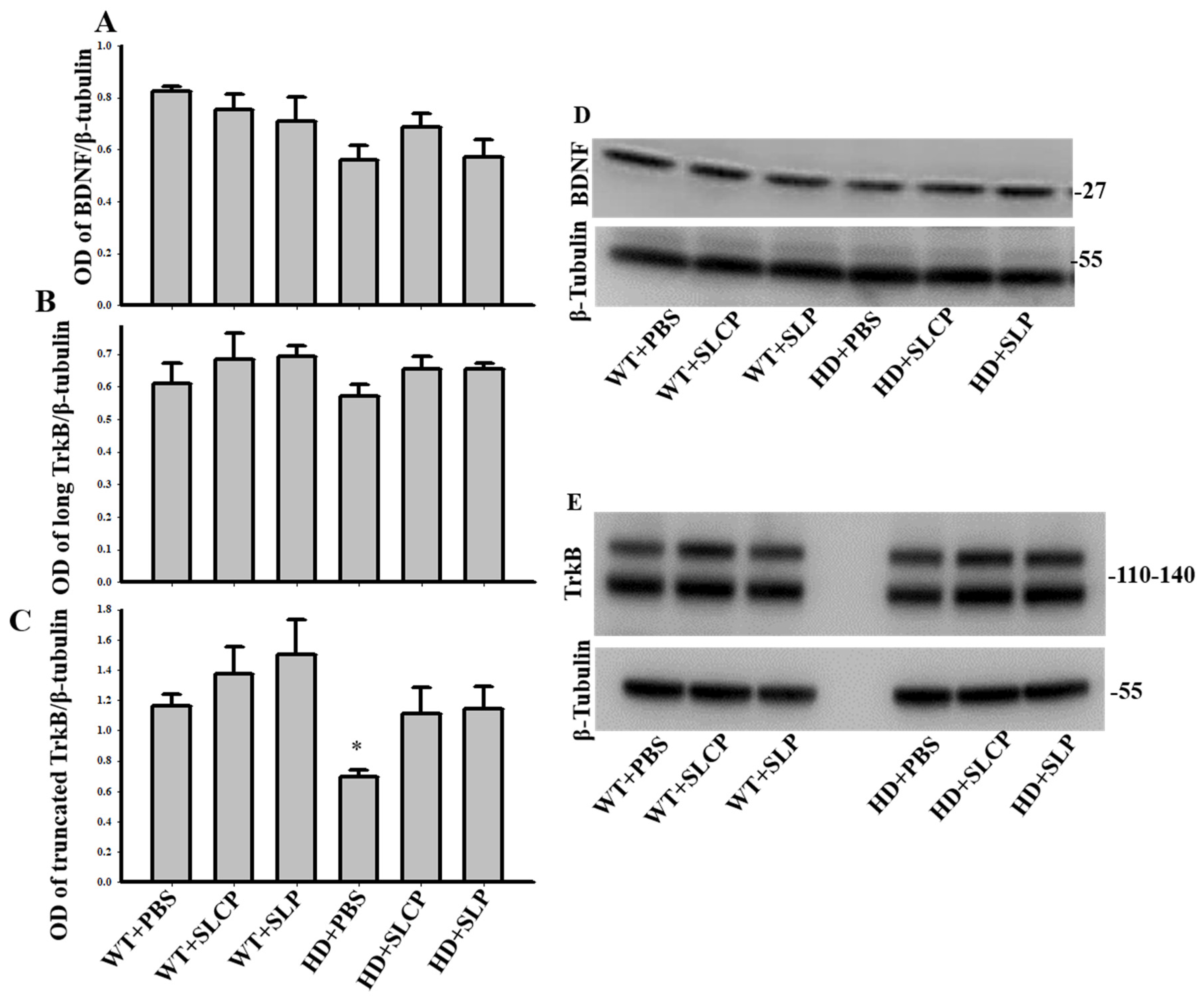 Ijms 21 09542 g005 Ijms 21 09542 g005