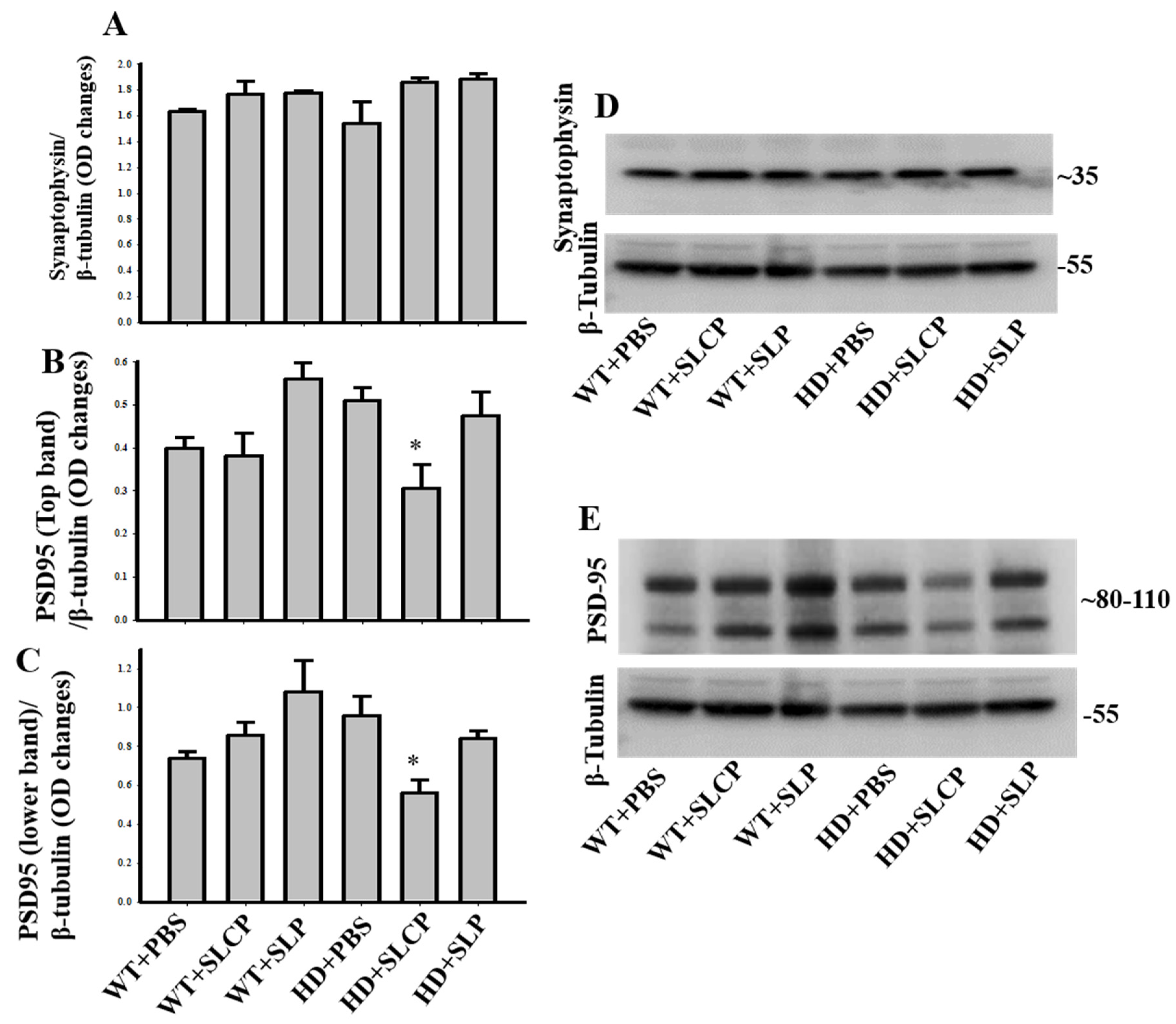 Ijms 21 09542 g006 Ijms 21 09542 g006