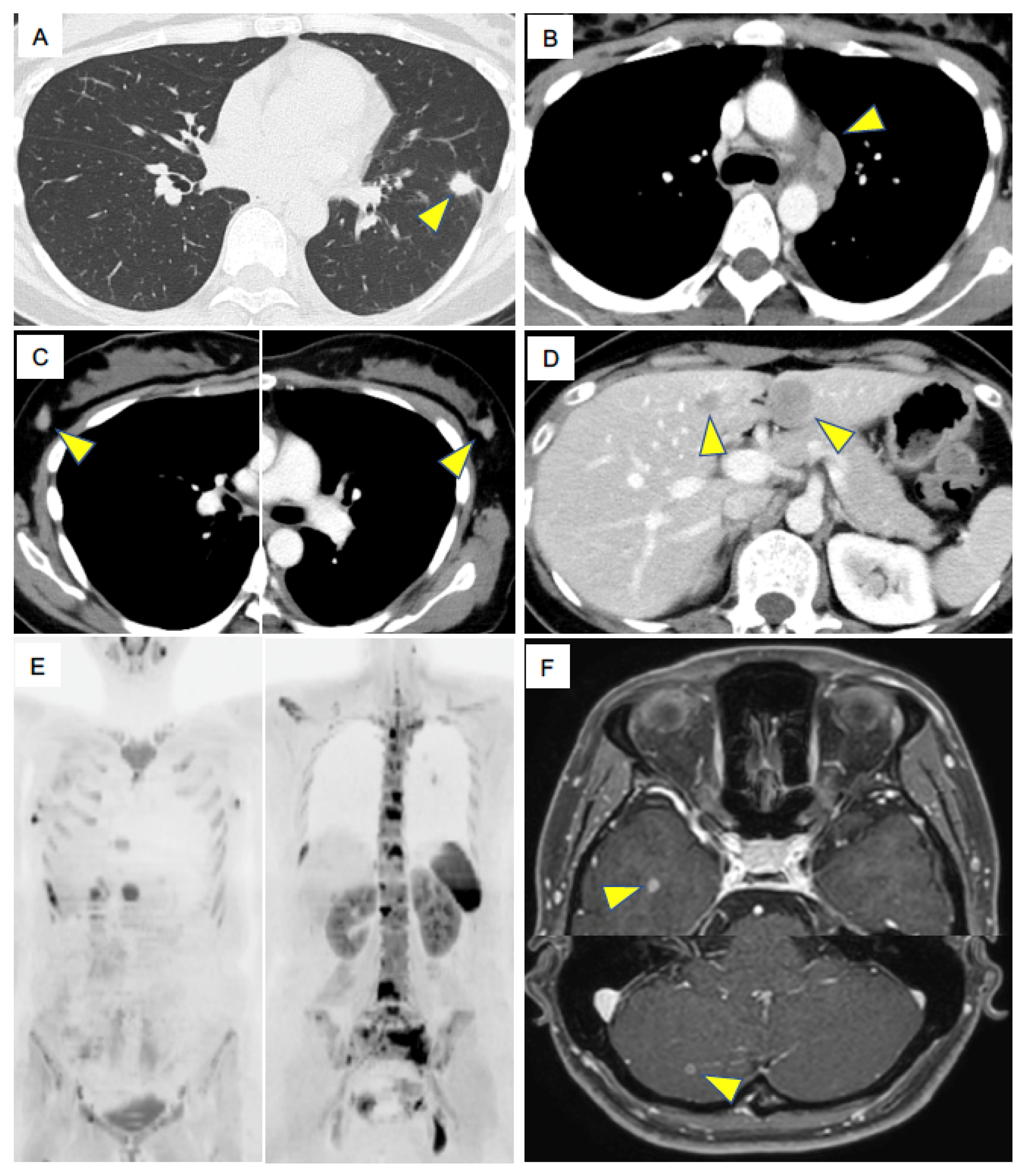 Ijms 21 09705 g001 Ijms 21 09705 g001