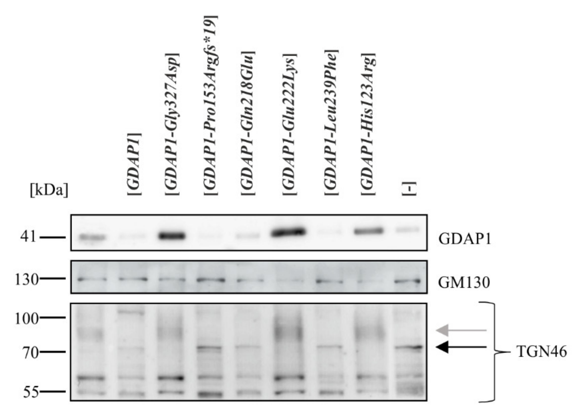 Ijms 22 00914 g004 Ijms 22 00914 g004
