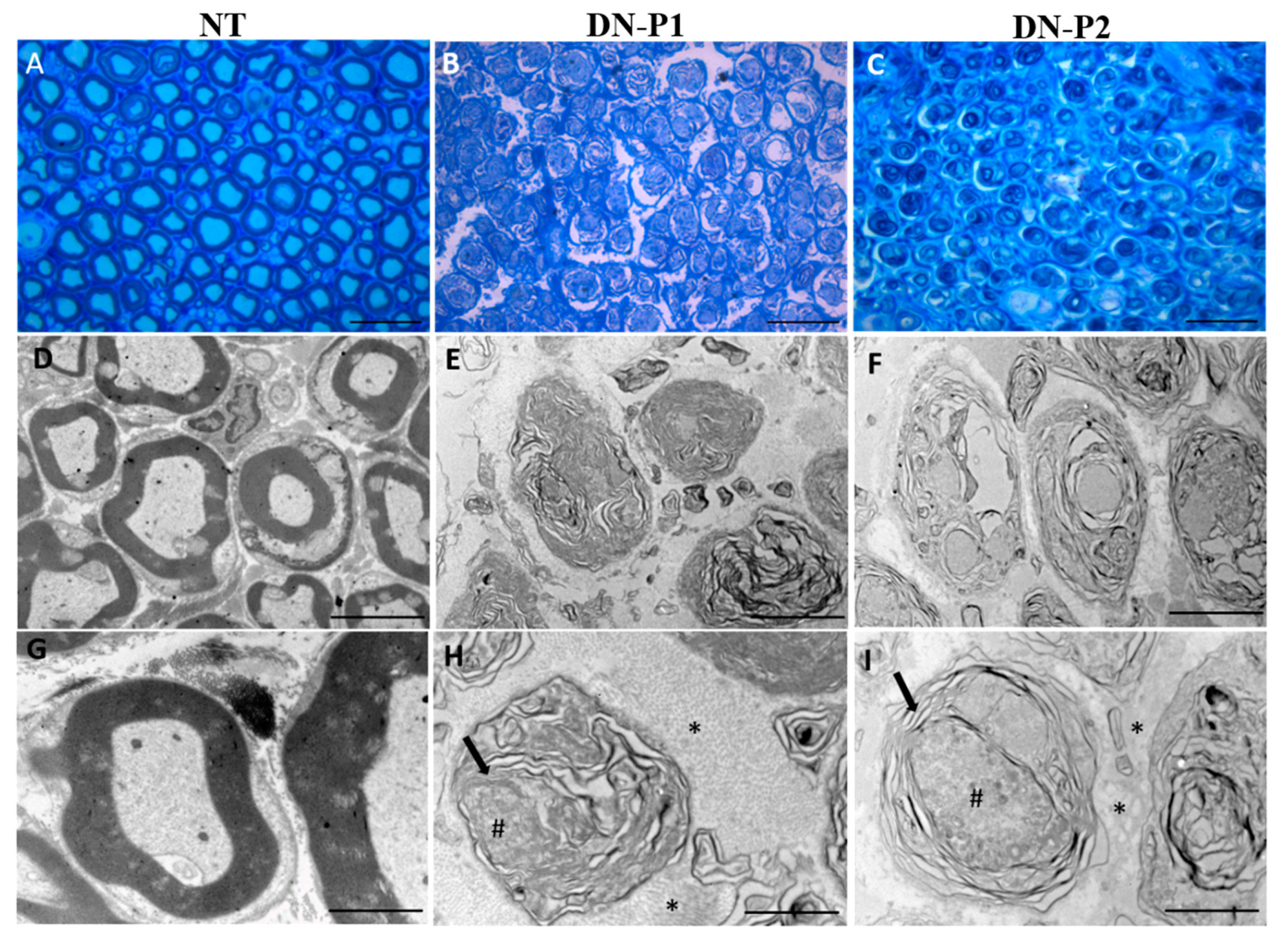 Ijms 22 02389 g006