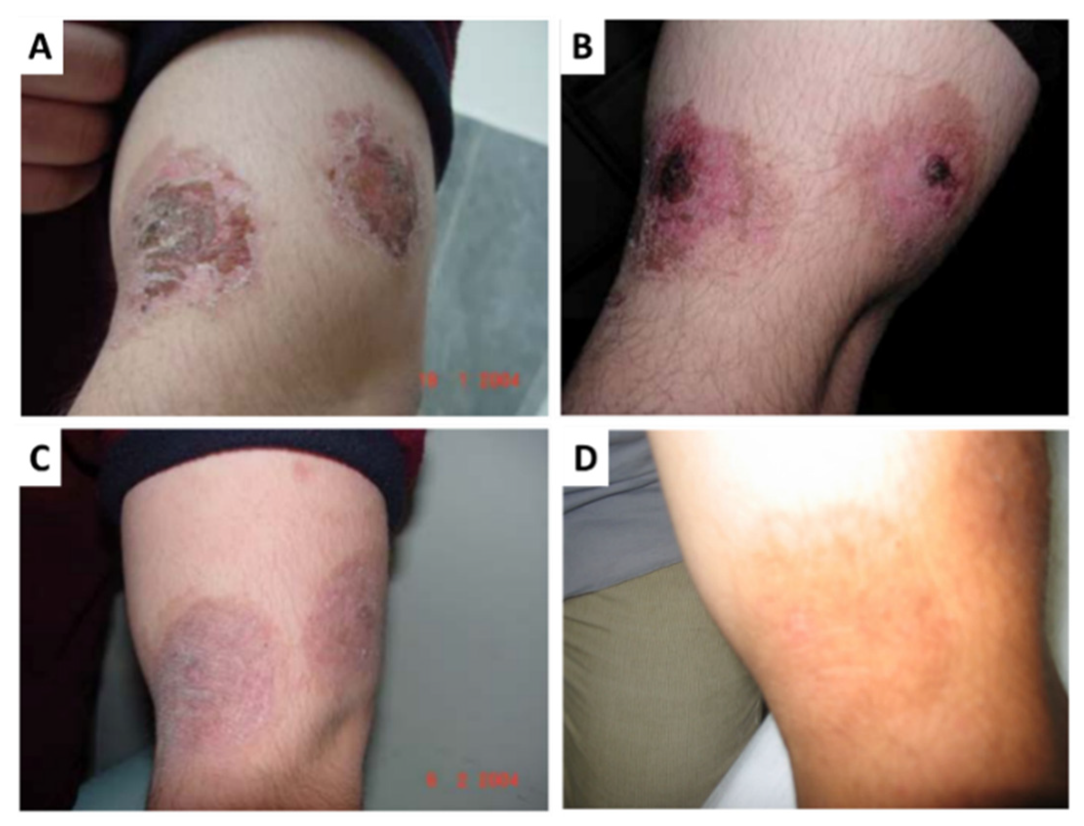 Ijms 22 04121 g005 Ijms 22 04121 g005