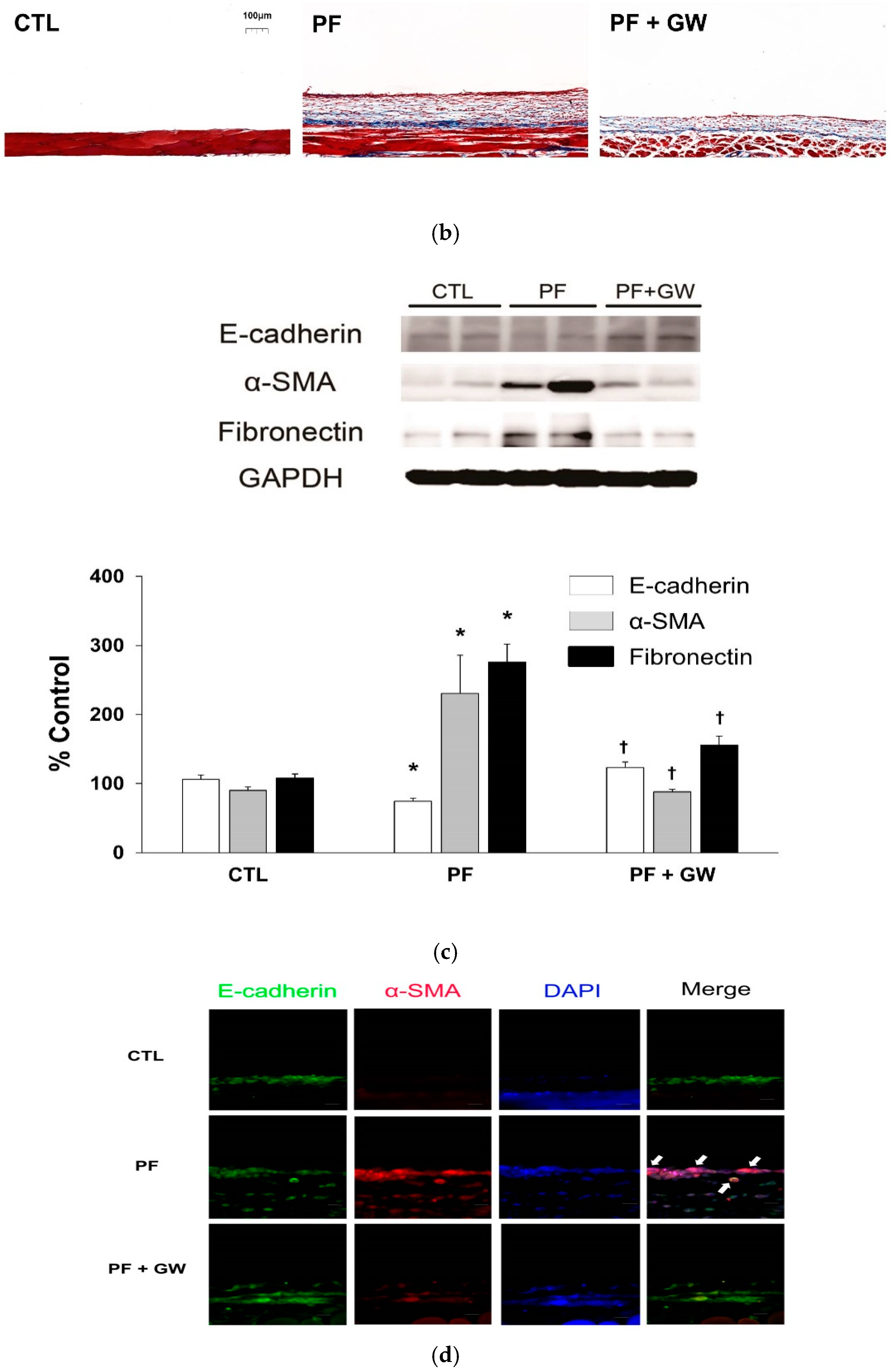 Ijms 22 04739 g004b Ijms 22 04739 g004b