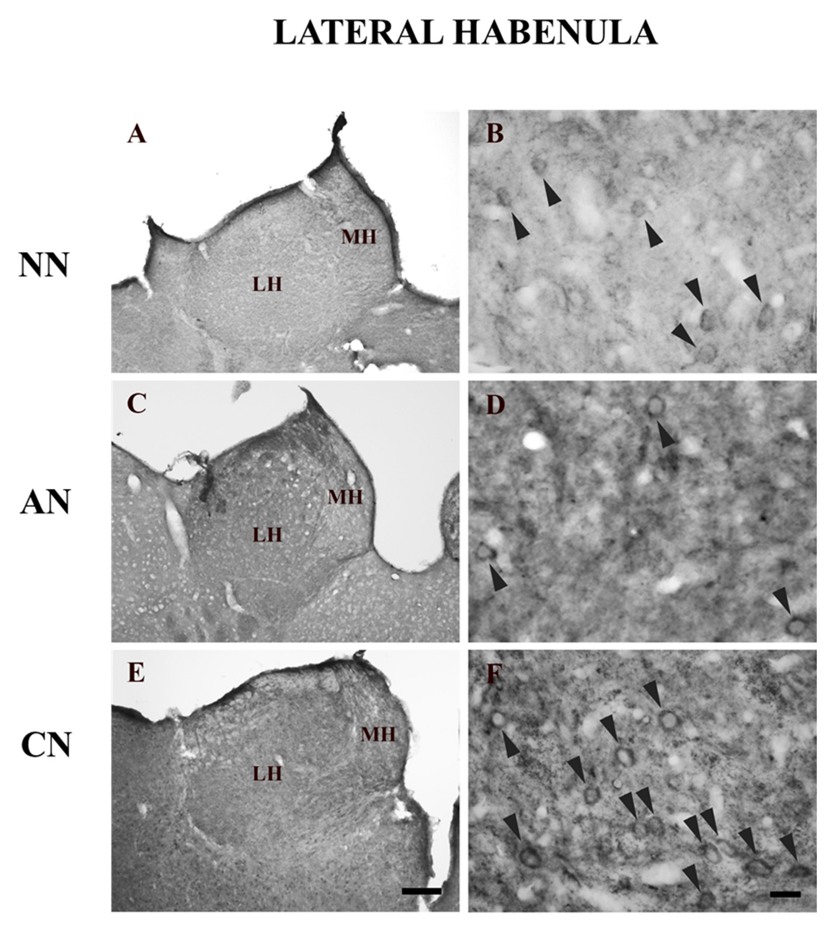 Ijms 22 04775 g002 Ijms 22 04775 g002