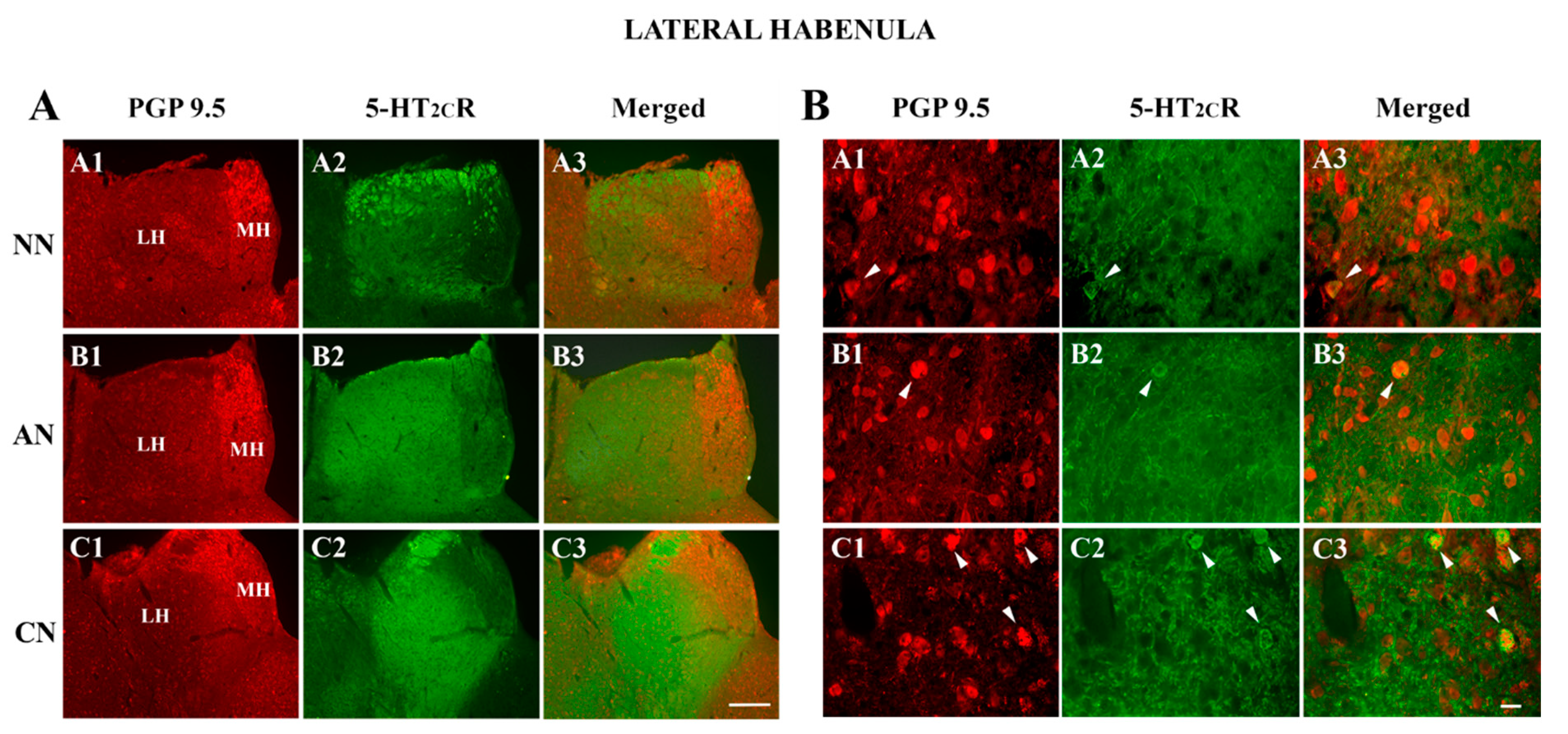 Ijms 22 04775 g003 Ijms 22 04775 g003