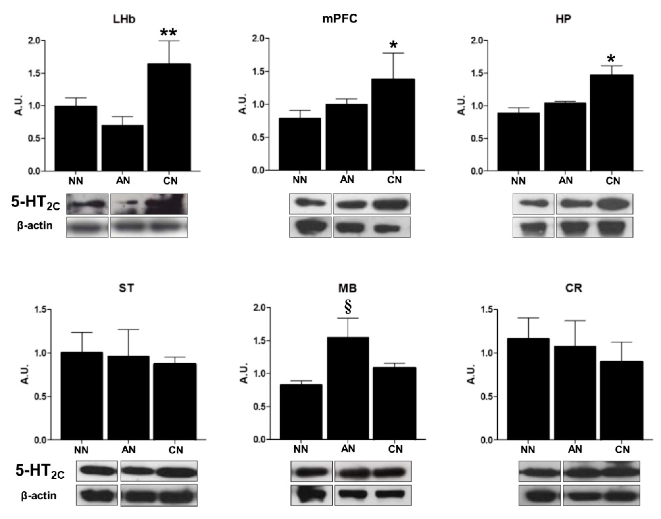 Ijms 22 04775 g004 Ijms 22 04775 g004