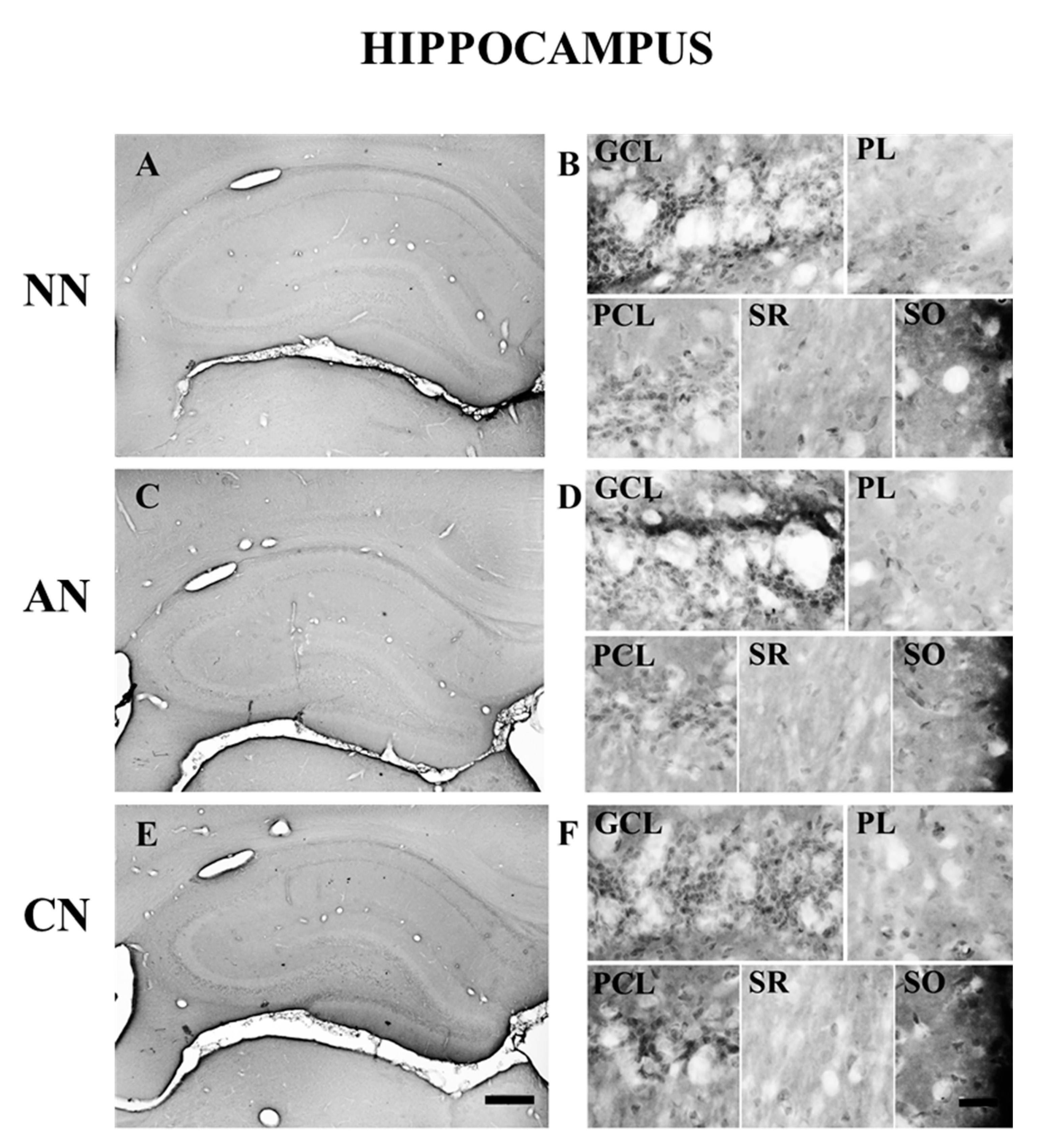 Ijms 22 04775 g006 Ijms 22 04775 g006
