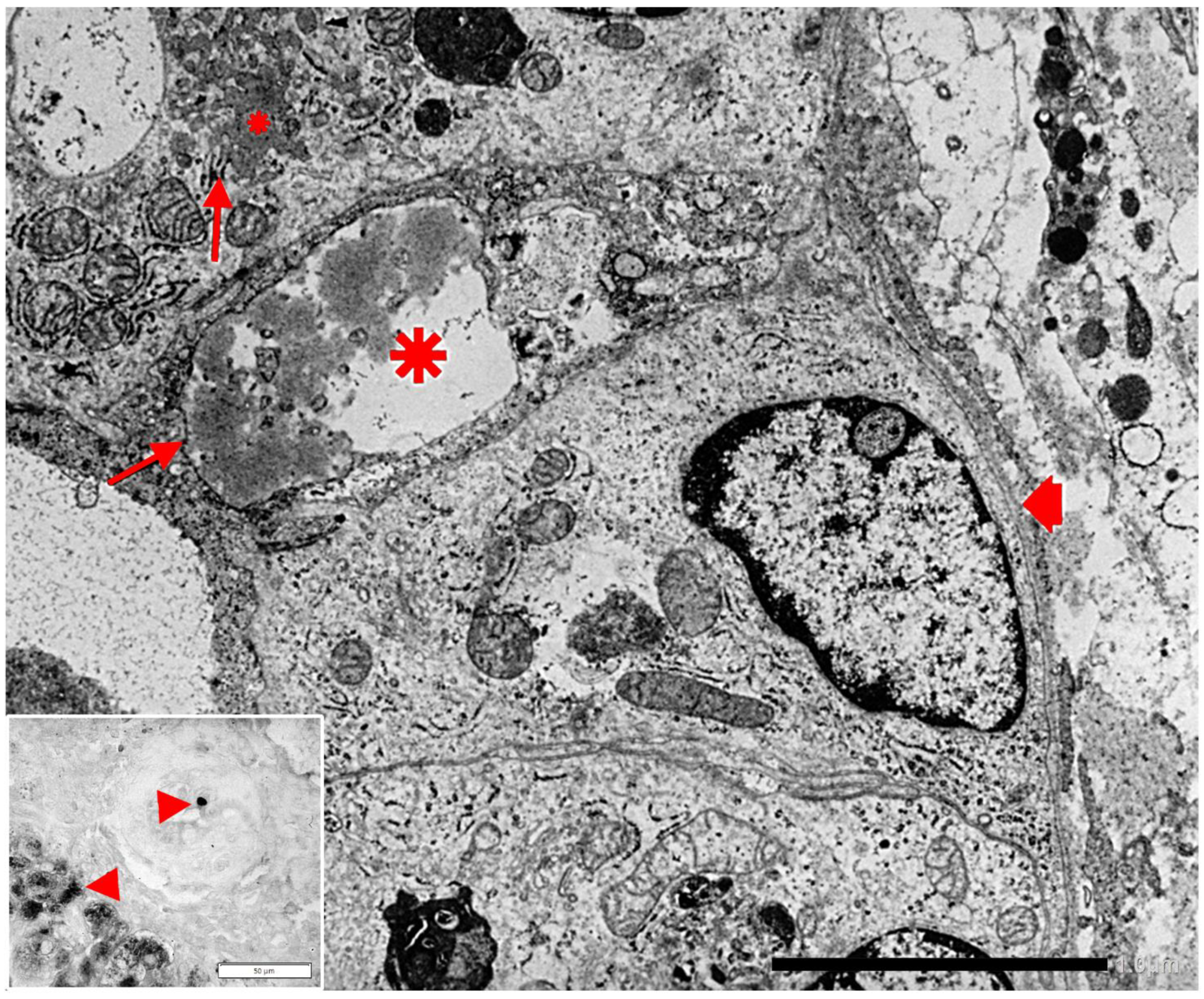 Ijms 22 05778 g003 Ijms 22 05778 g003