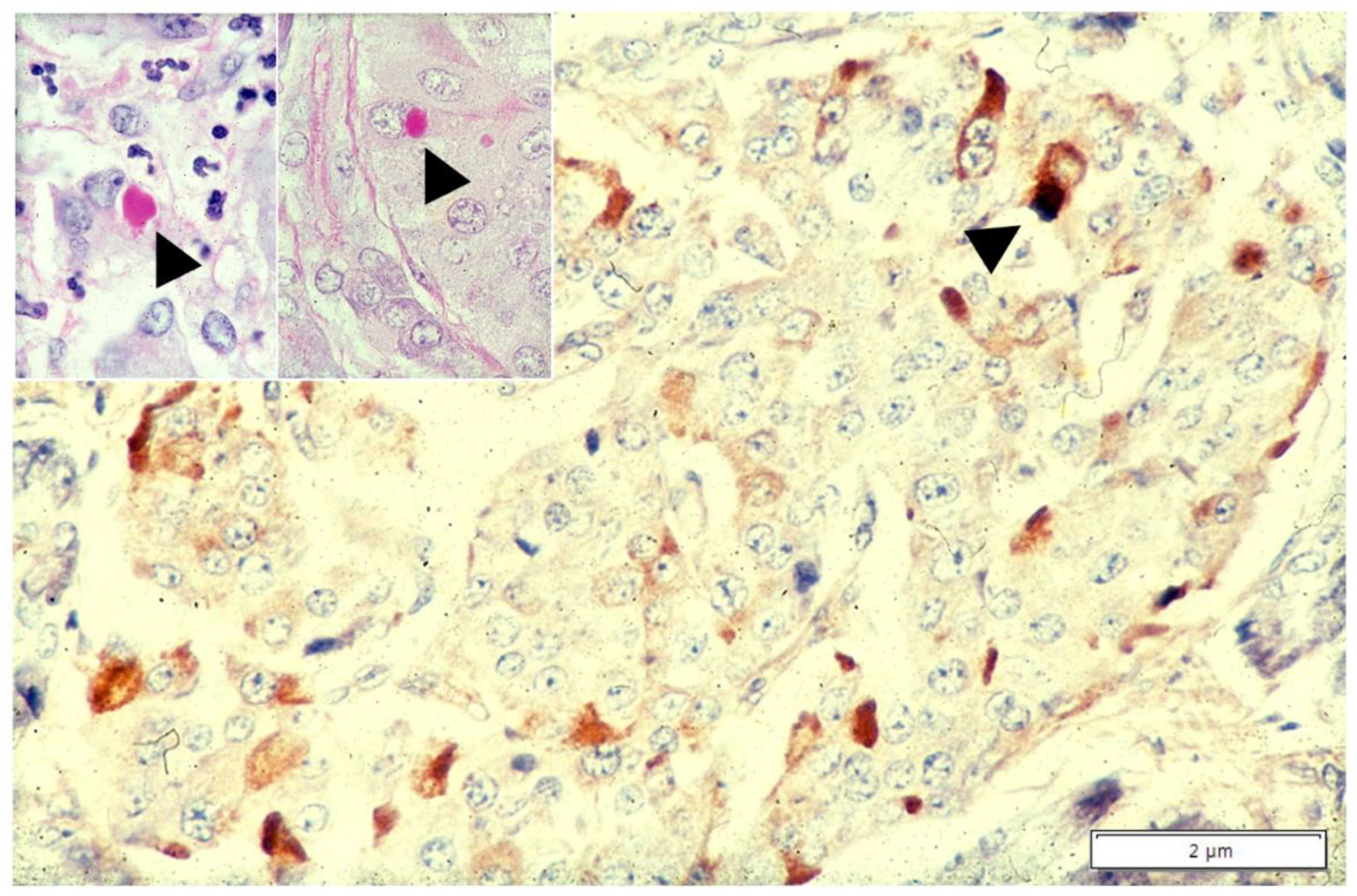 Ijms 22 05778 g009 Ijms 22 05778 g009