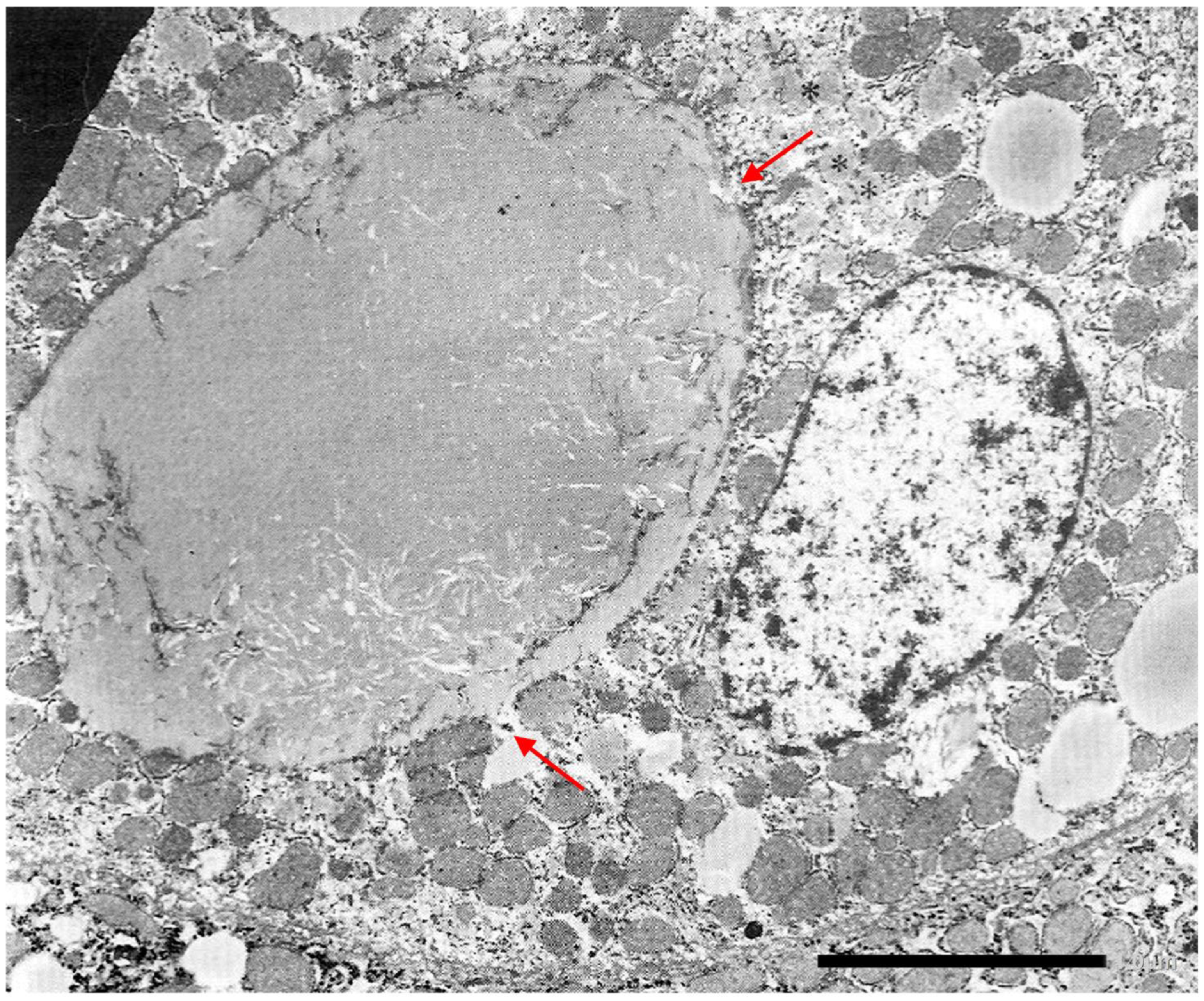 Ijms 22 05778 g016 Ijms 22 05778 g016